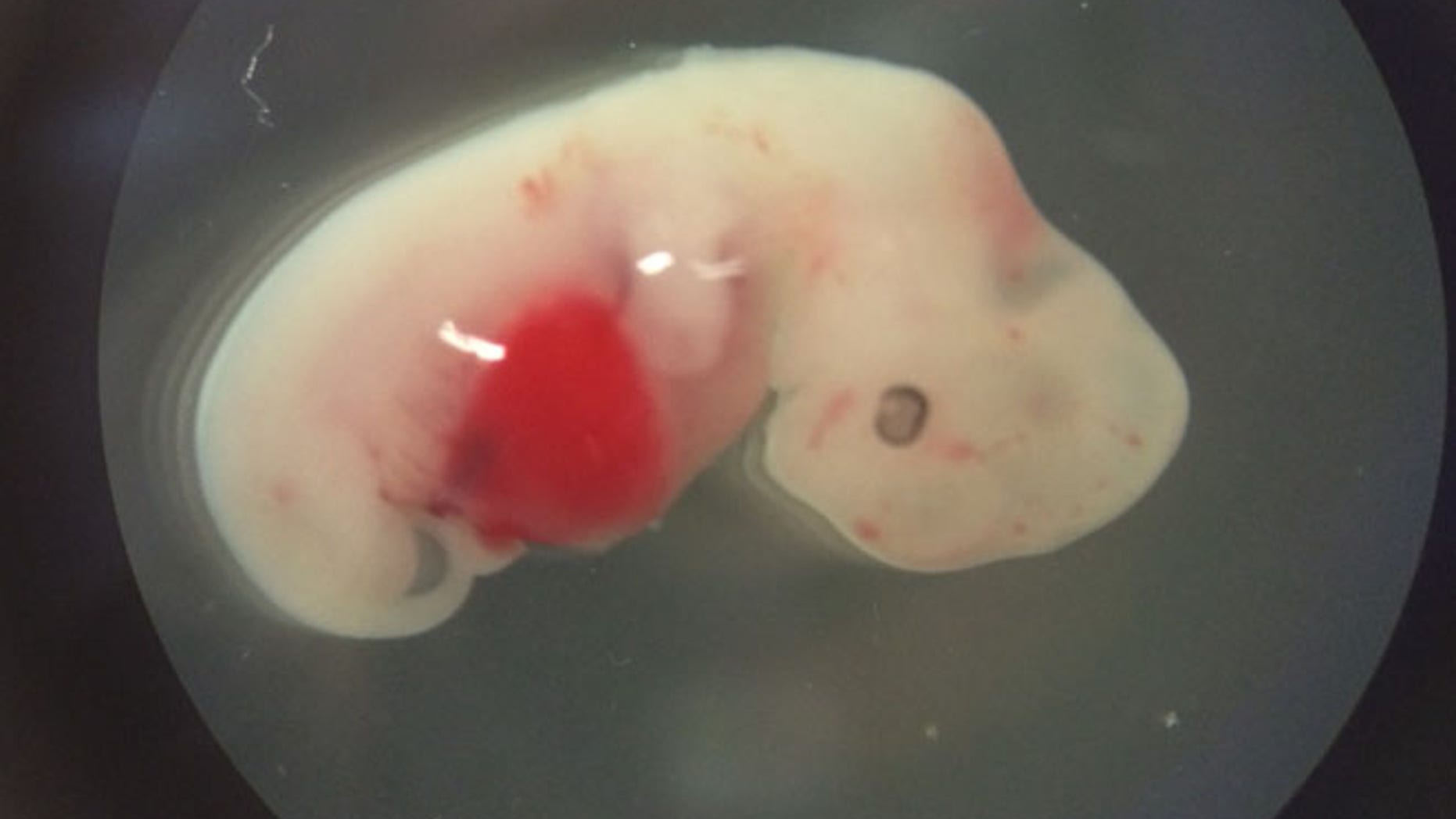 This undated photo provided by the Salk Institute on Jan. 24, 2017 shows a 4-week-old pig embryo which had been injected with human stem cells. The experiment was a very early step toward the possibility of growing human organs inside animals for transplantation.