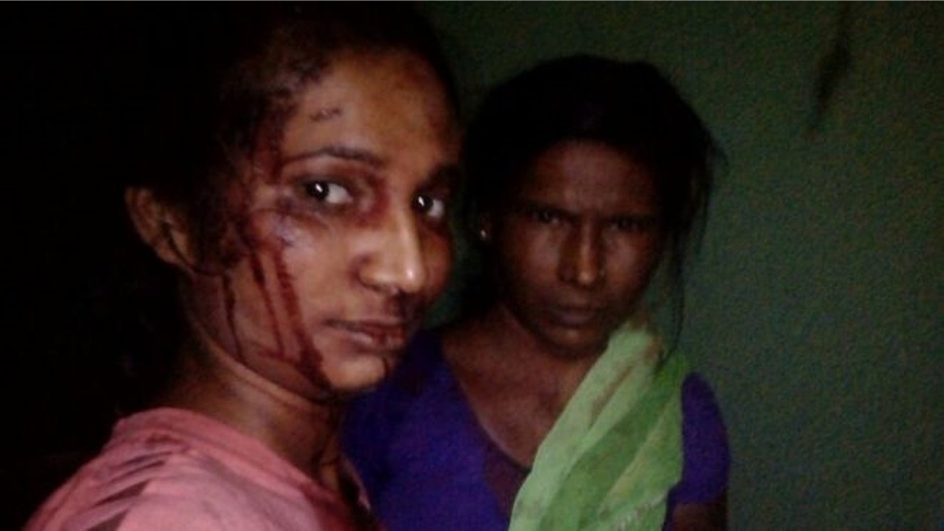 Rupali Meshram takes a photo of her and her mother, Jijabhai, following a fight with a tiger.