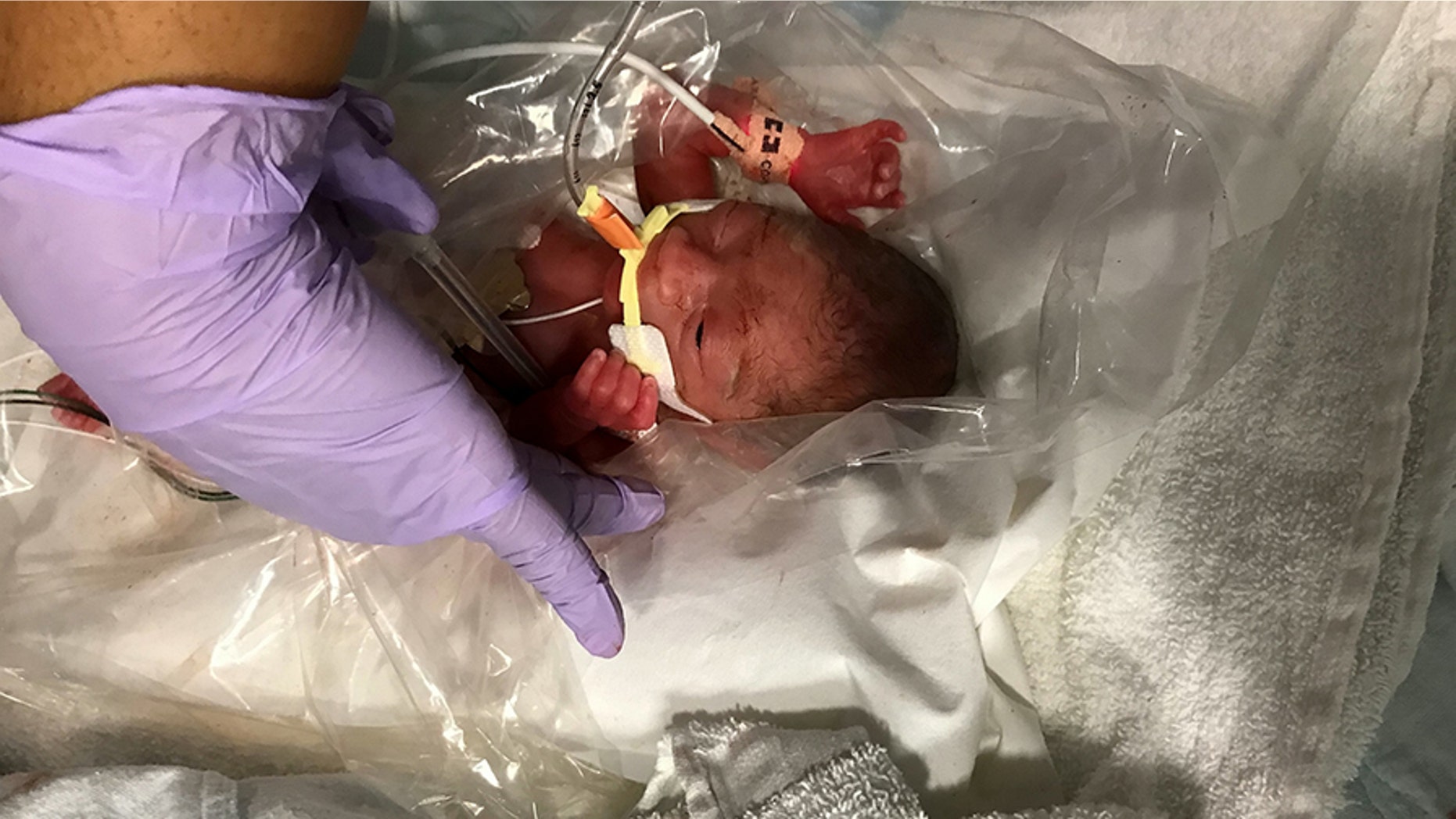 Baby Markcus Cropper, Jr weighed 1 pound, 10 ounces at birth. Mother says he is her "little fighter."