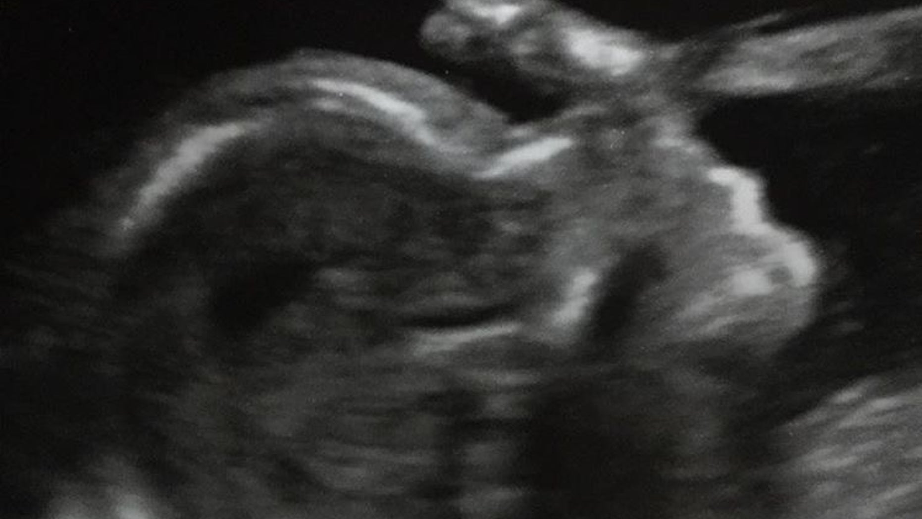 49ers' wide receiver Torrey Smith shared his unborn child's health scare with fans.