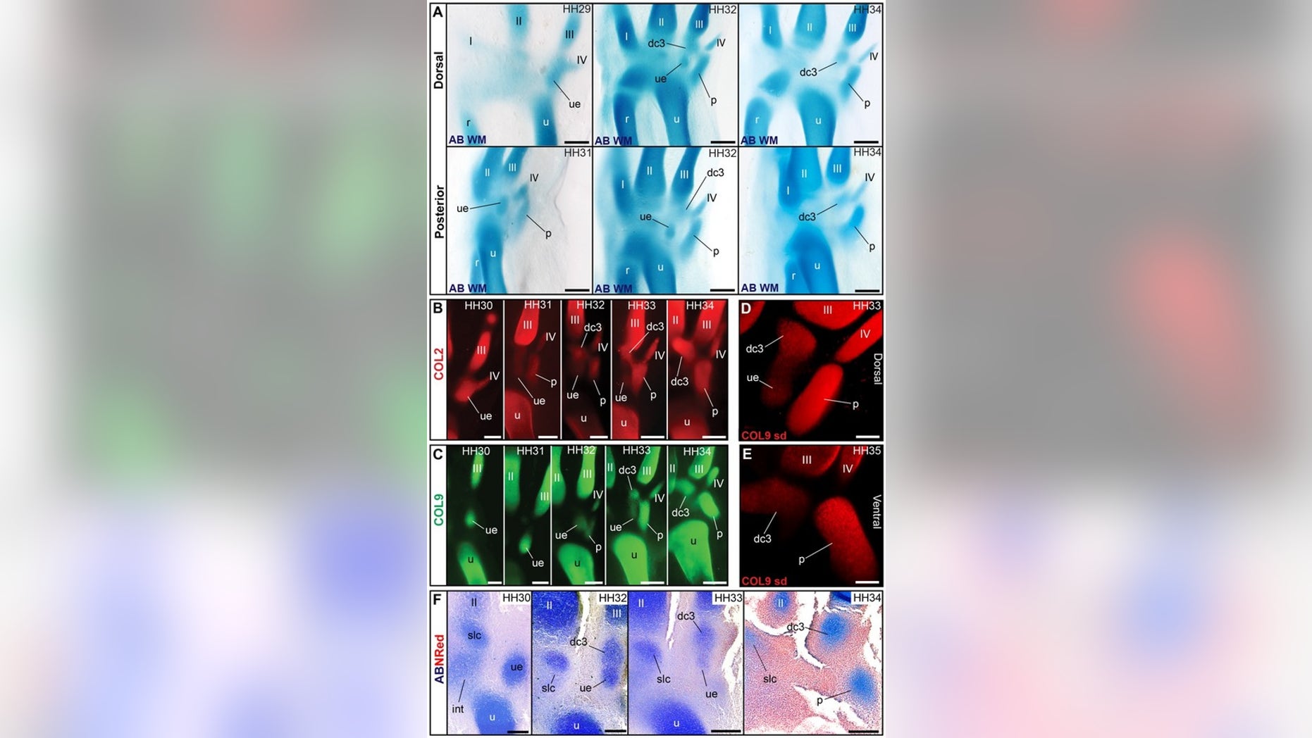 The ulnare bone (labeled ue) forms and vanishes during the development of a chicken embryo.