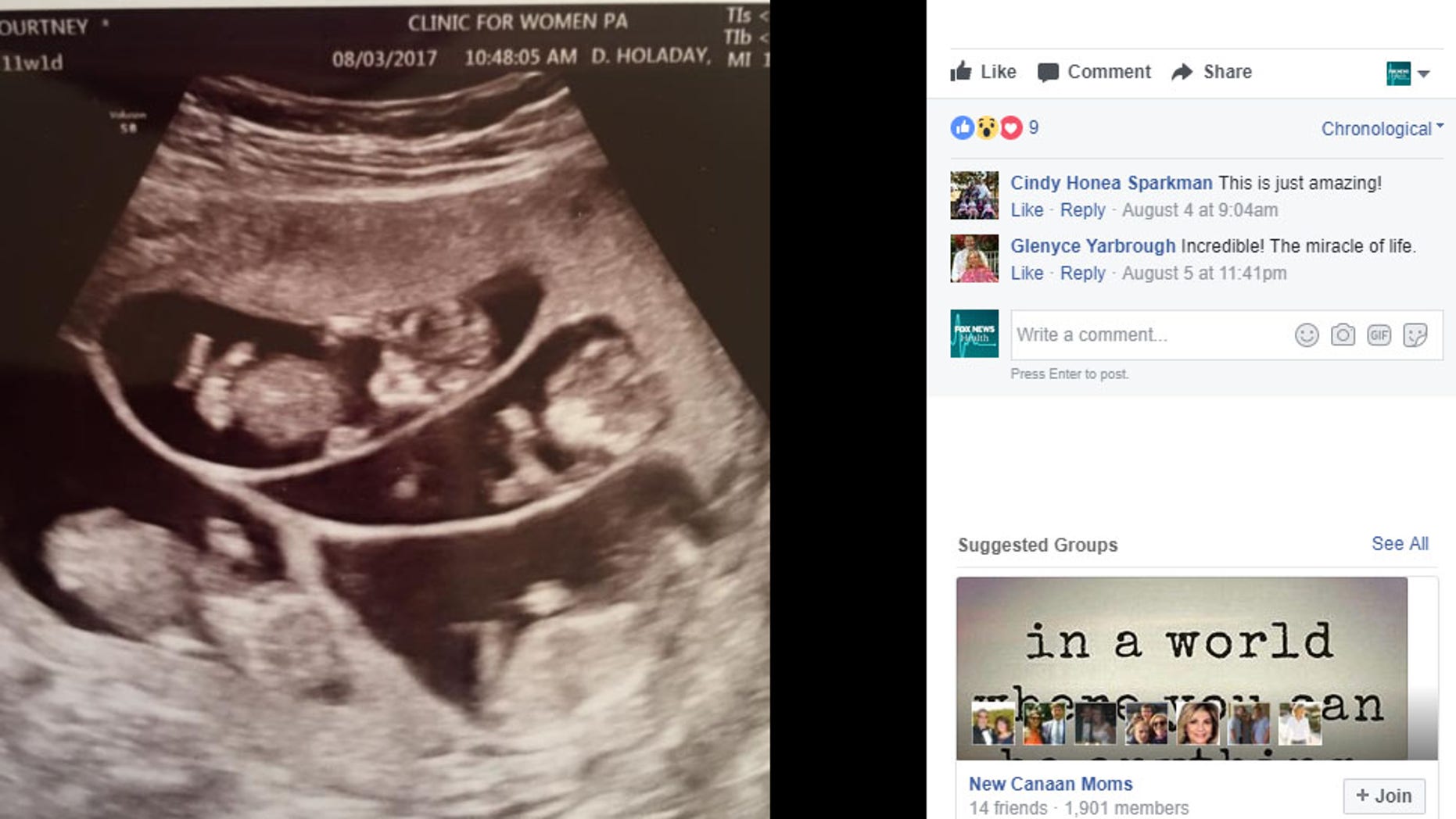 Mom Of 3 Shocked To Learn Shes Expecting Sextuplets Fox News 