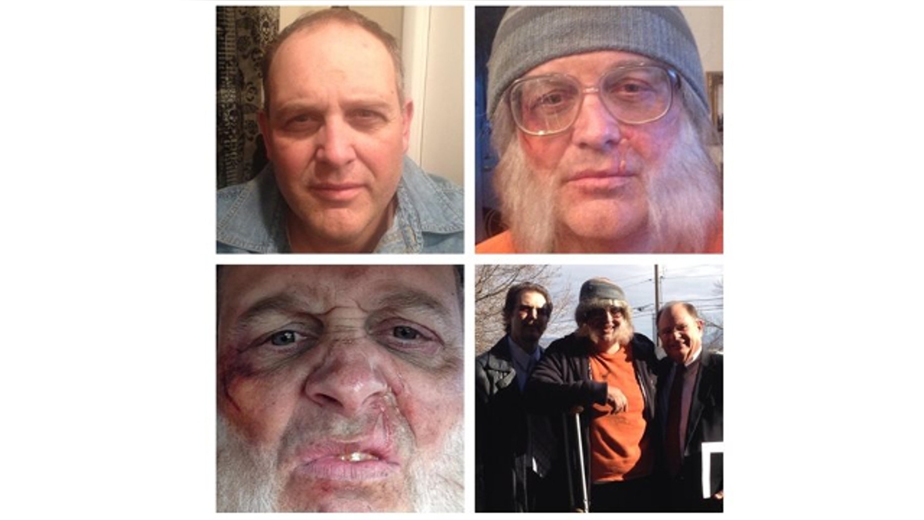 This photo combo of images taken Sunday, Nov. 24, 2013, and provided by Tara Sterling, shows David Musselman, a bishop for The Church of Jesus Christ of Latter-day Saints in Taylorsville, Utah, who had makeup artist Tara Starling transform him to appear battered and homeless.