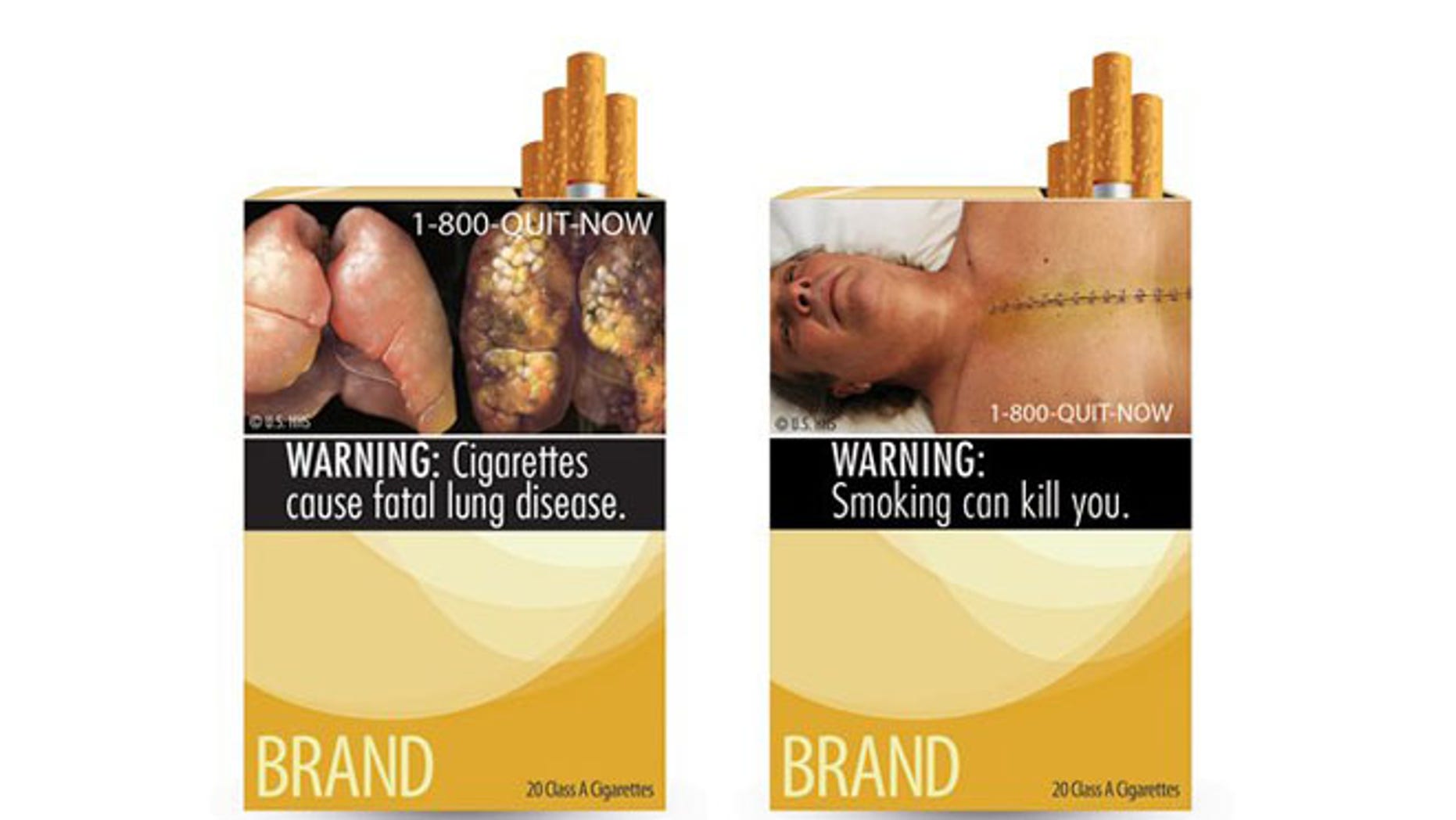 FILE - In this combo made from file images provided by the U.S. Food and Drug Administration shows two of nine new warning labels cigarette makers will have to use by the fall of 2012. An appeals court says New York City cannot try to scare smokers by requiring grotesque images of diseased lungs and decaying gums at stores that sell cigarettes. It says the federal government gets to decide how to warn people about the dangers of smoking tobacco. The 2nd U.S. Circuit Court of Appeals in Manhattan issued its ruling Tuesday, July 10, 2012. It rejected a 2009 city Board of Health resolution requiring tobacco retailers to display signs bearing graphic images showing the adverse health effects of smoking. (AP Photo/U.S. Food and Drug Administration, File)