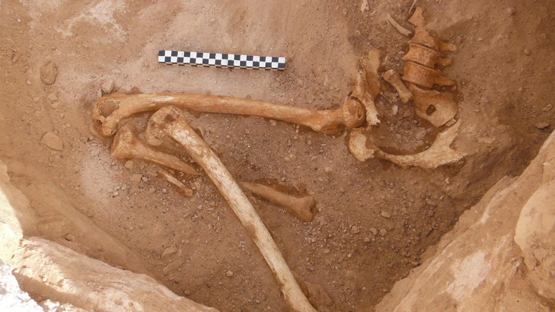 Remains of the pregnant woman's fetus bones in her pelvis can be seen in this photo. She was in her first trimester when she died.
