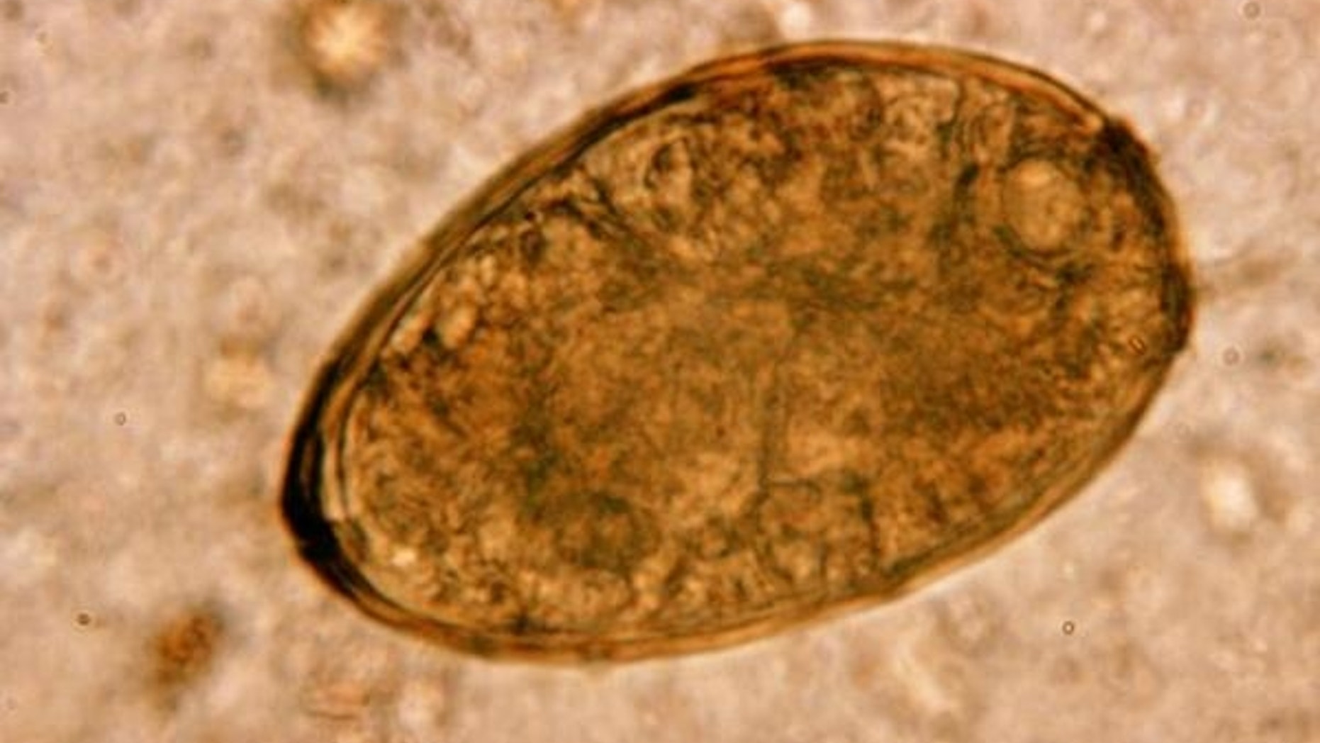 This photo shows an egg from the fluke worm parasite Paragonimus westermani, which can infect the lungs of people who eat raw shellfish.