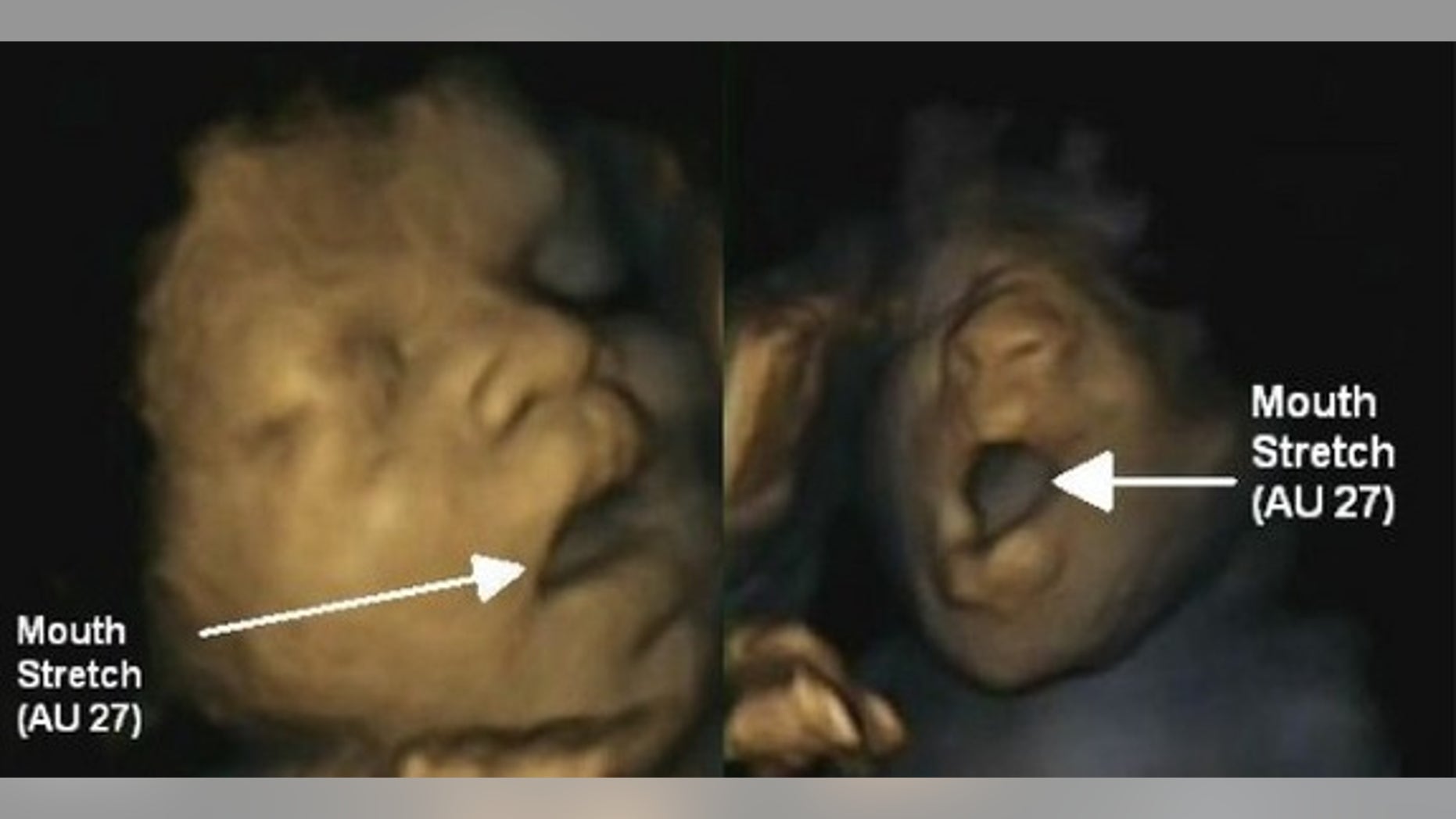 Ultrasound videos have captured fetuses yawning in the womb.