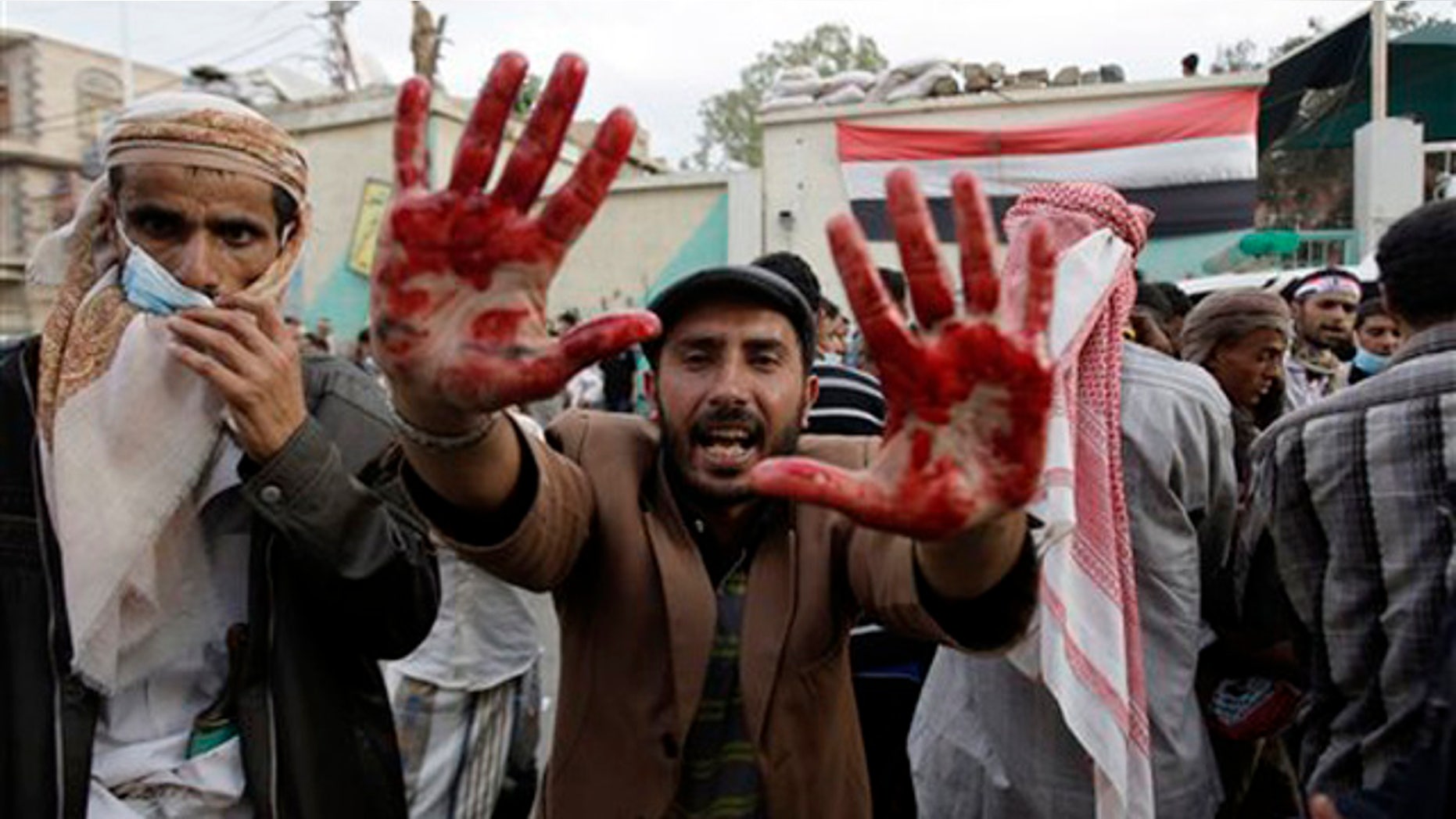 An anti-government protester holds out his blood-stained hands after clashes with security forces, in Sanaa, Yemen, Sunday, Sept. 18, 2011. Yemeni government forces opened fire with anti-aircraft guns and automatic weapons on tens of thousands of anti-government protesters in the capital pushing for ouster of longtime ruler Ali Abdullah Saleh, killing several people and wounding dozens.(AP Photo/Hani Mohammed)
