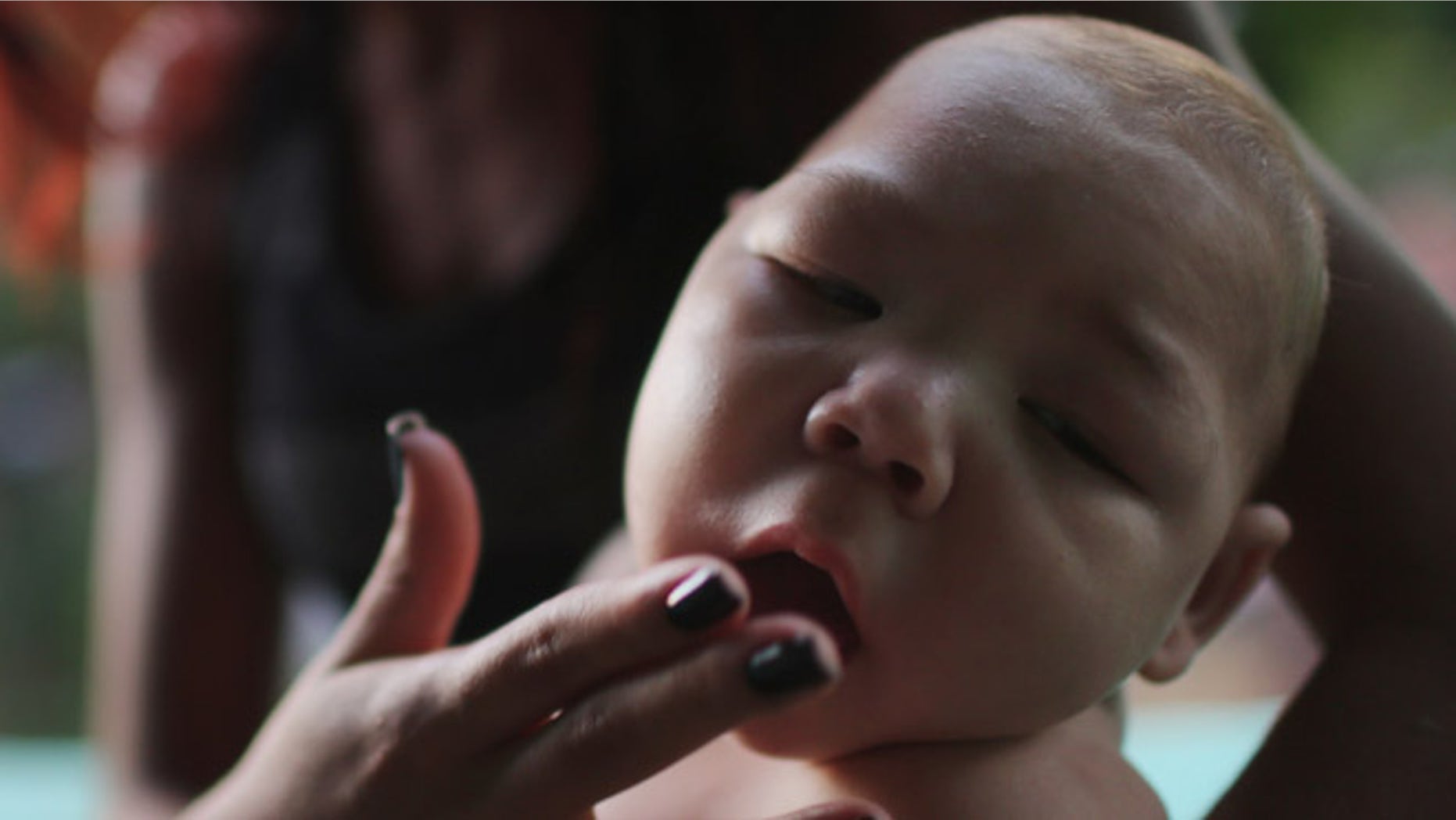 RECIFE, BRAZIL - JANUARY 25: Estafany Perreira holds her nephew David Henrique Ferreira, 5 months, who has microcephaly, on January 25, 2016 in Recife, Brazil. In the last four months, authorities have recorded close to 4,000 cases in Brazil in which the mosquito-borne Zika virus may have led to microcephaly in infants. Microcephaly results in newborns with abnormally small heads and is associated with various disorders including decreased brain development. According to the World Health Organization (WHO), the Zika virus outbreak is likely to further spread in South, Central and North America. At least twelve cases of Zika in the United States have now been confirmed by the CDC. (Photo by Mario Tama/Getty Images)