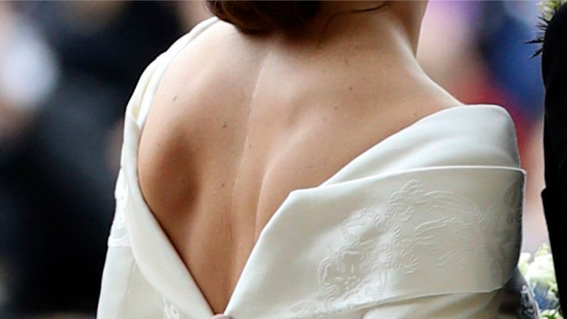Princess Eugenie of York shows off her scar in her wedding dress on Friday, Oct. 12, 2018.