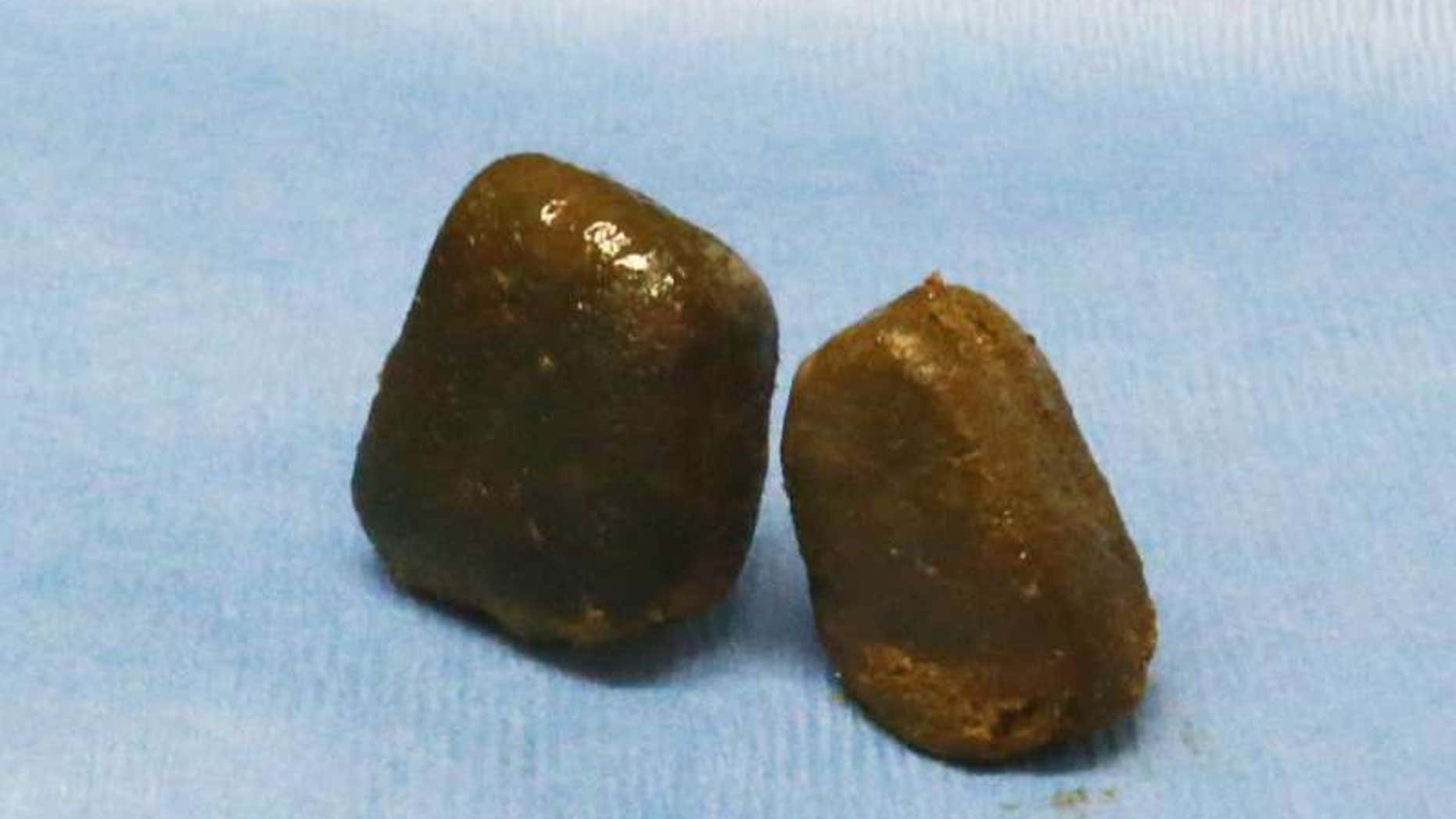 Scientists Finally Know How Wombat Butts Make Cube shaped Poops Fox News scientists-finally-know-how-wombat-butts-make-cube-shaped-poops-fox-news