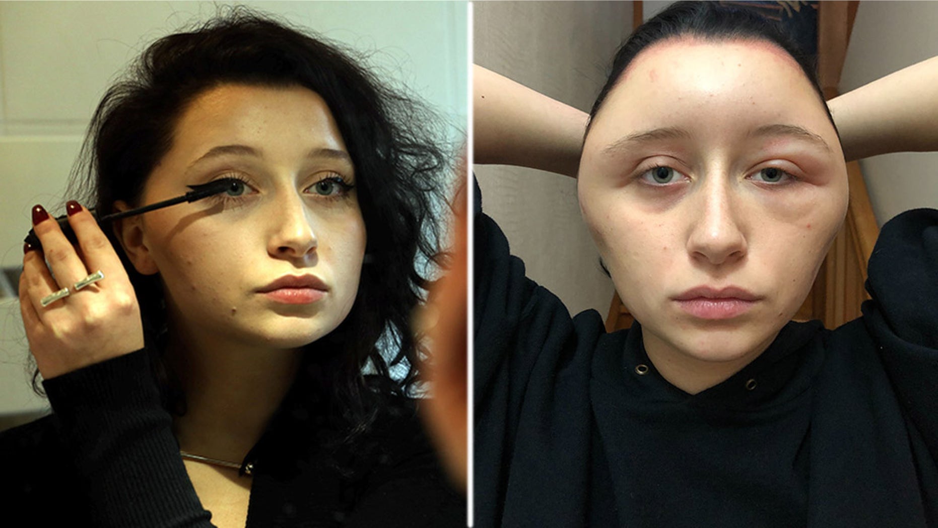 A French woman said that her head had become swollen after an allergic reaction to the hair dye.