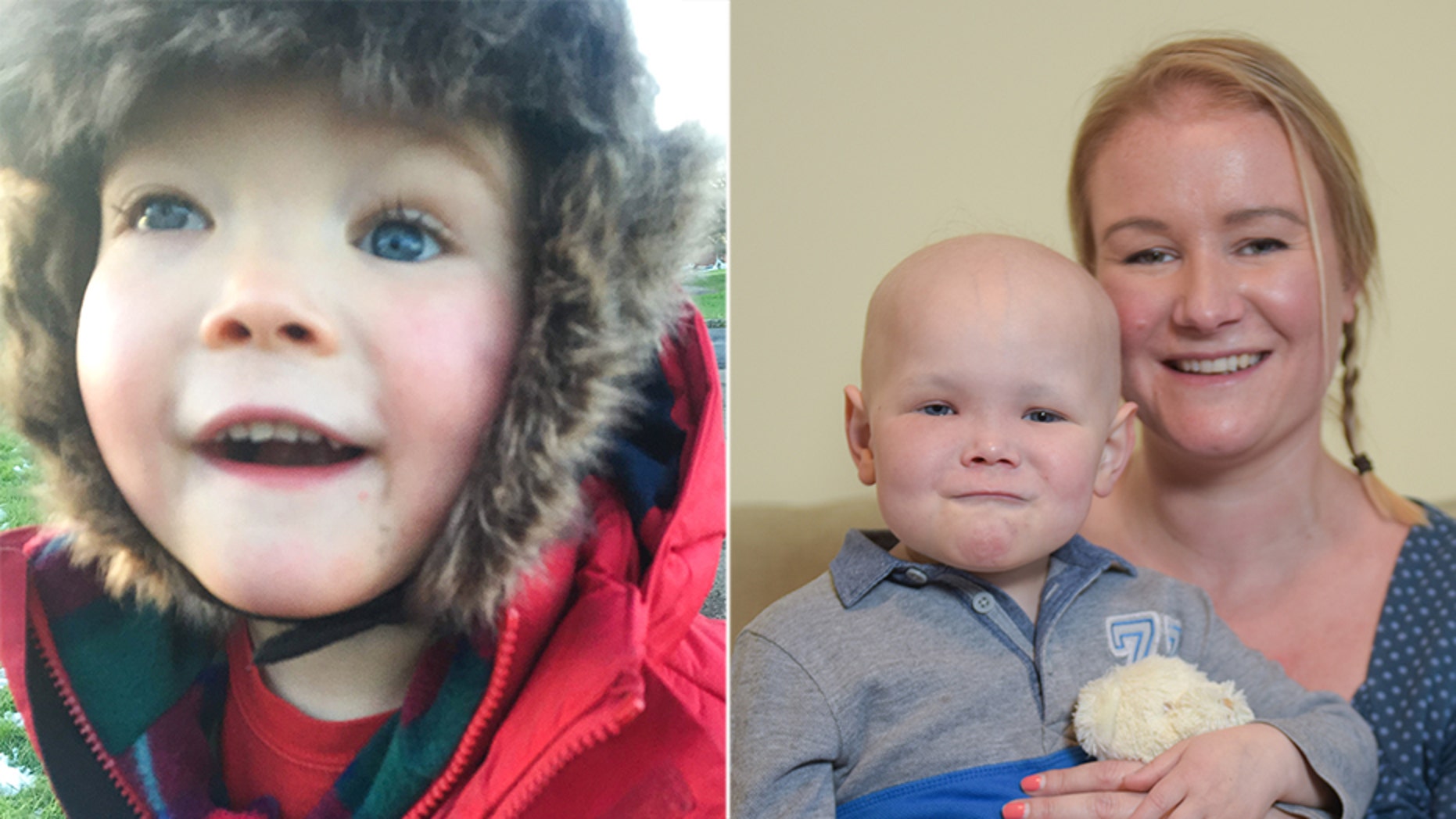 The cancer had altered the bone structure around Harri's eye and required several types of treatment.
