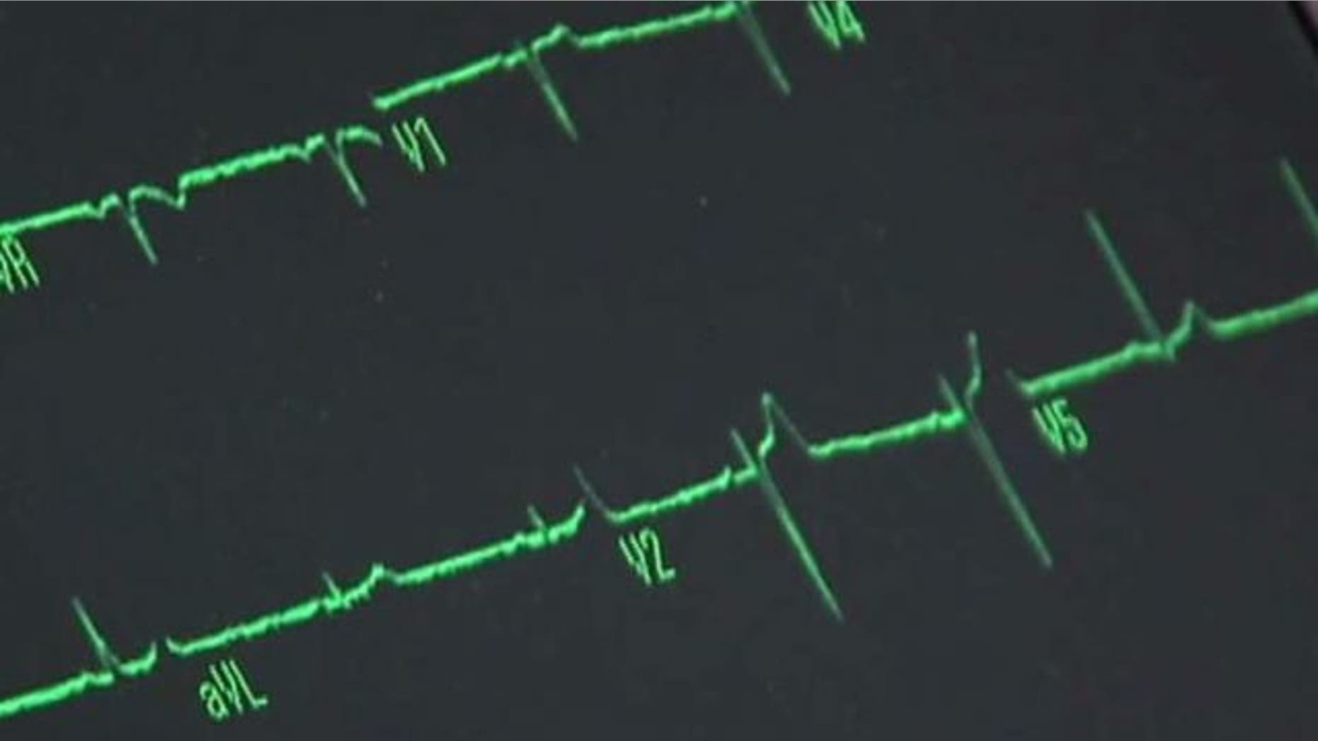 A woman who recently survived a heart attack is sharing her story to help others identify the signs.
