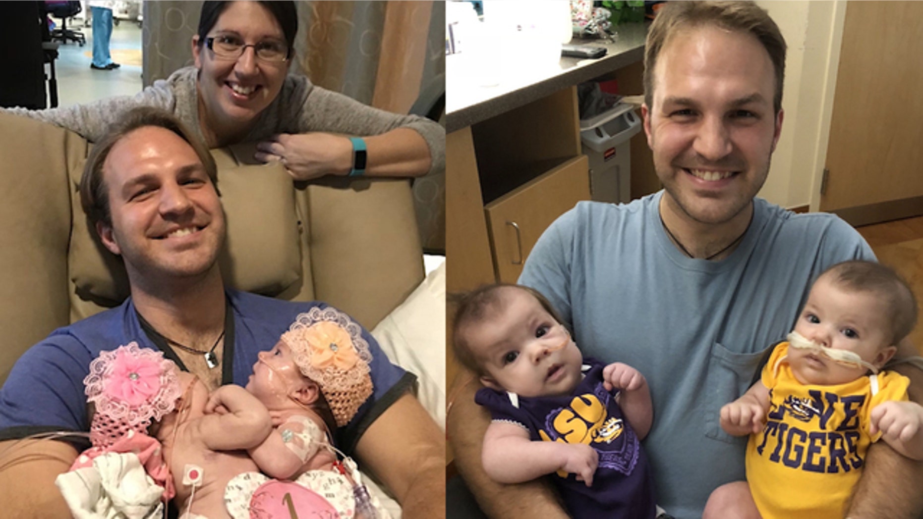 Jesi and Remi Pitre, pictured left before their separation surgery and right before being discharged, have headed home to Apopka.