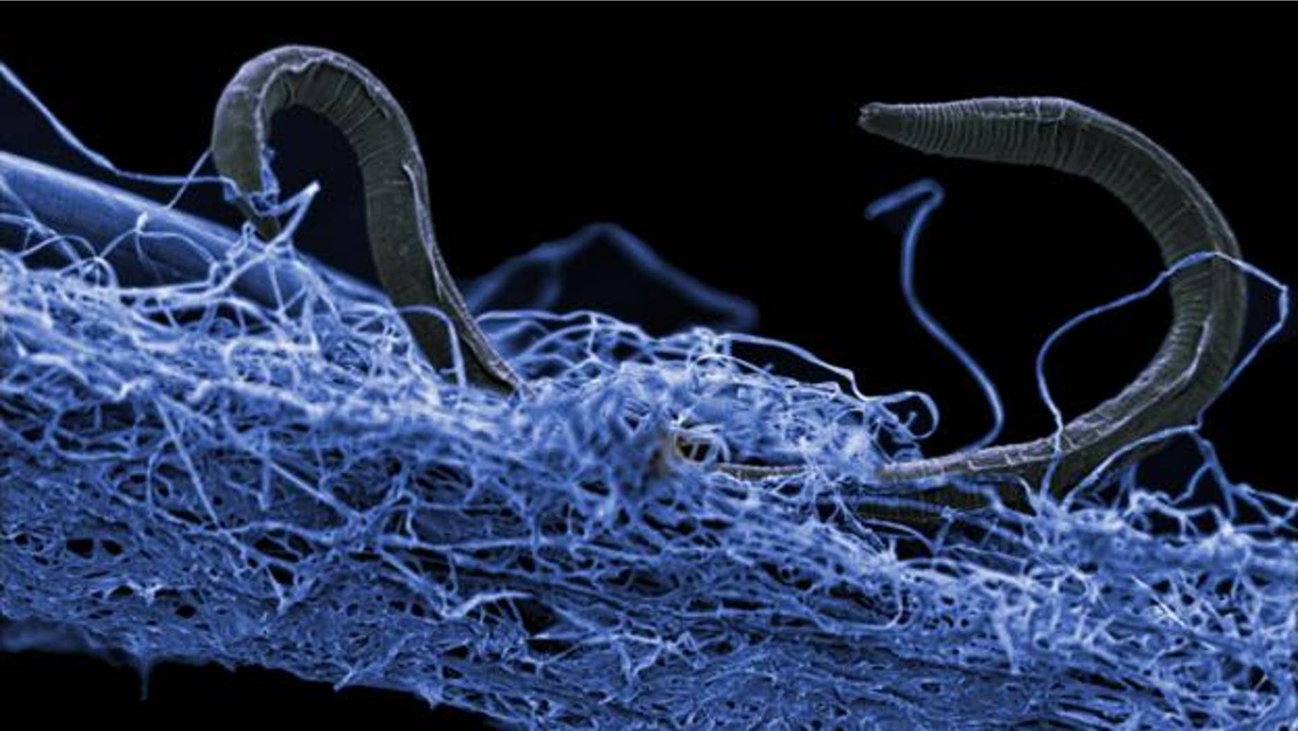 A nematode (eukaryote) in a biofilm of microorganisms. This deep-dwelling creature (<em>Poikilolaimus sp.</em>) was discovered in the Kopanang gold mine in South Africa, and was found 0.86 miles (1.4 km) below the surface.