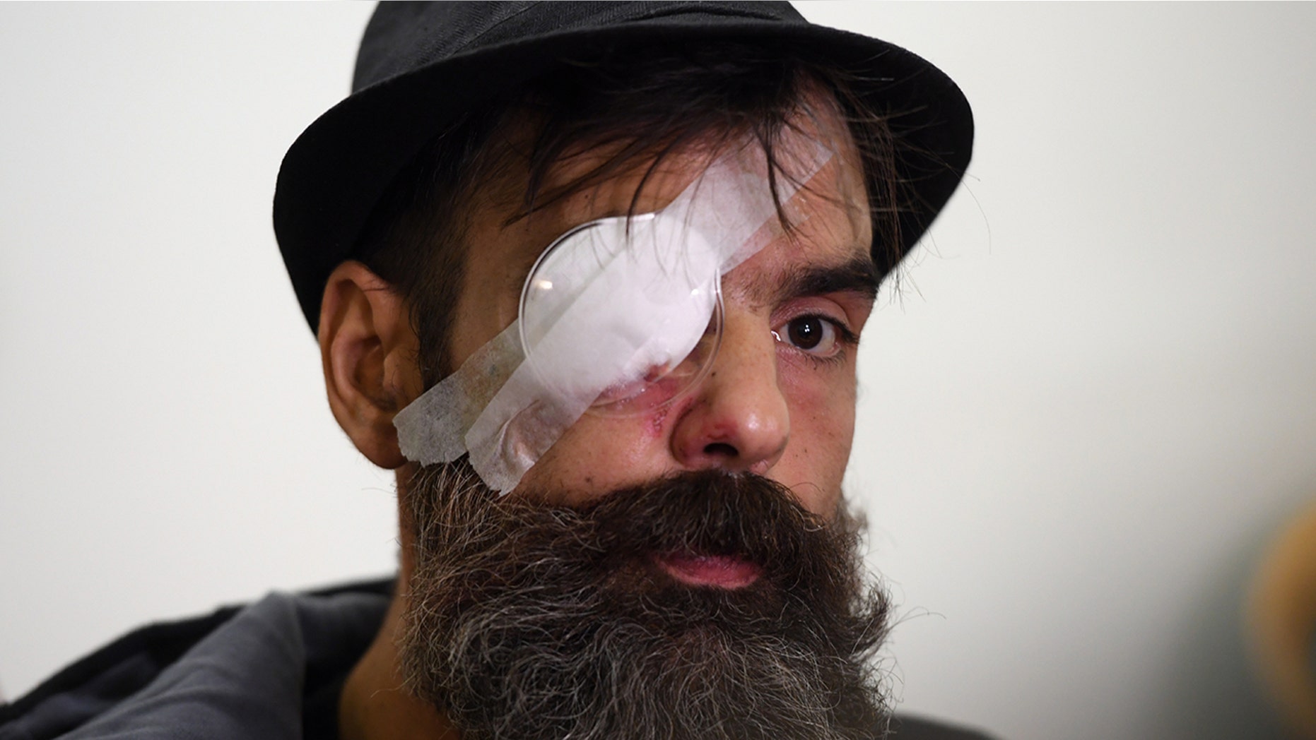 Jerome Rodrigues, one of the leaders of the yellow vest movement, gives a press conference, on January 27, 2019 at the Cochin hospital in Paris, one day after getting wounded in the eye during an anti-government demonstration called by the Yellow Vests