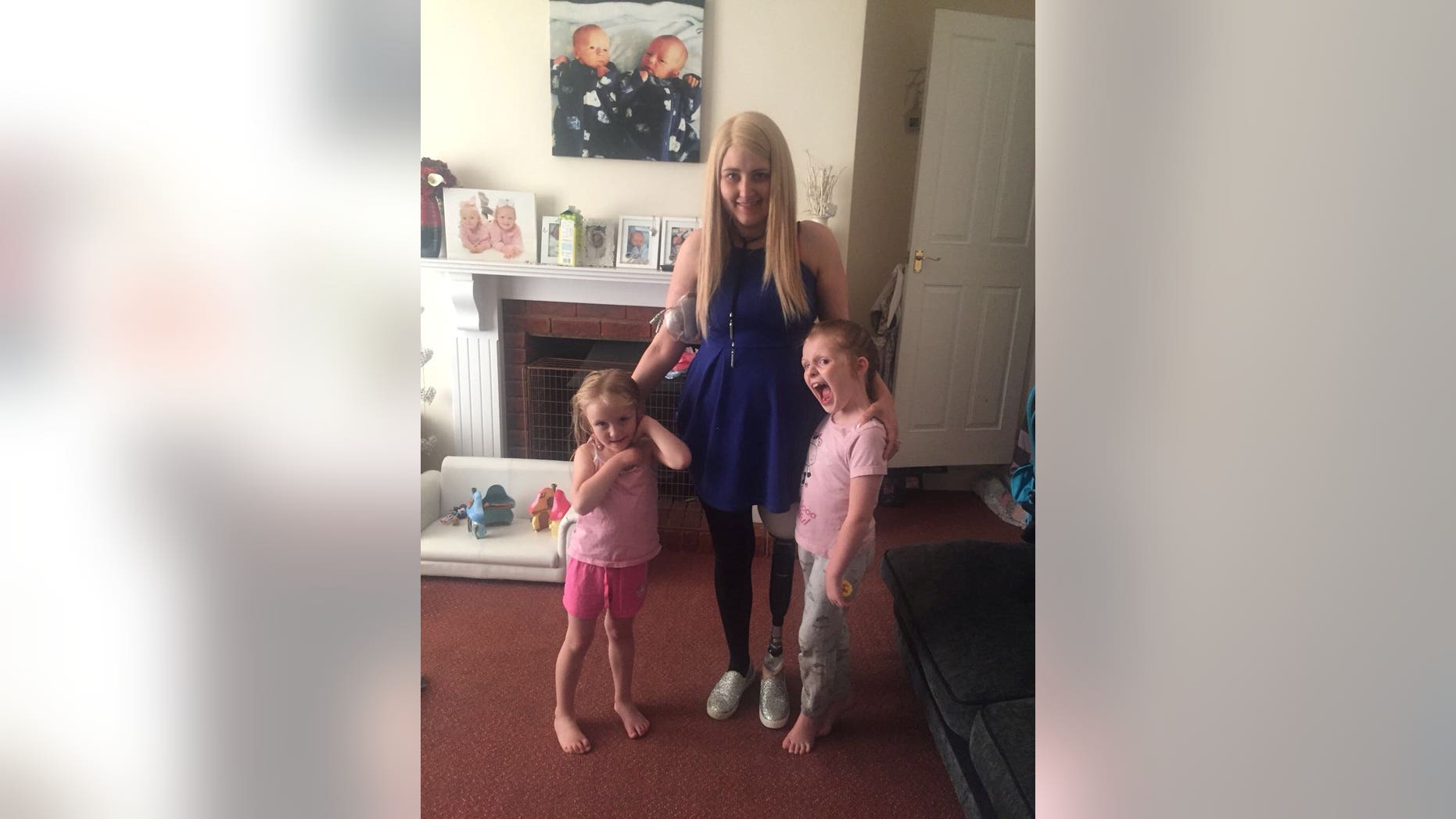 Dionne Brown, 26, who had her leg amputated to fight off cancer just months after giving birth to twins, is pictured with daughters Teigan, 6, and Halie, 4.