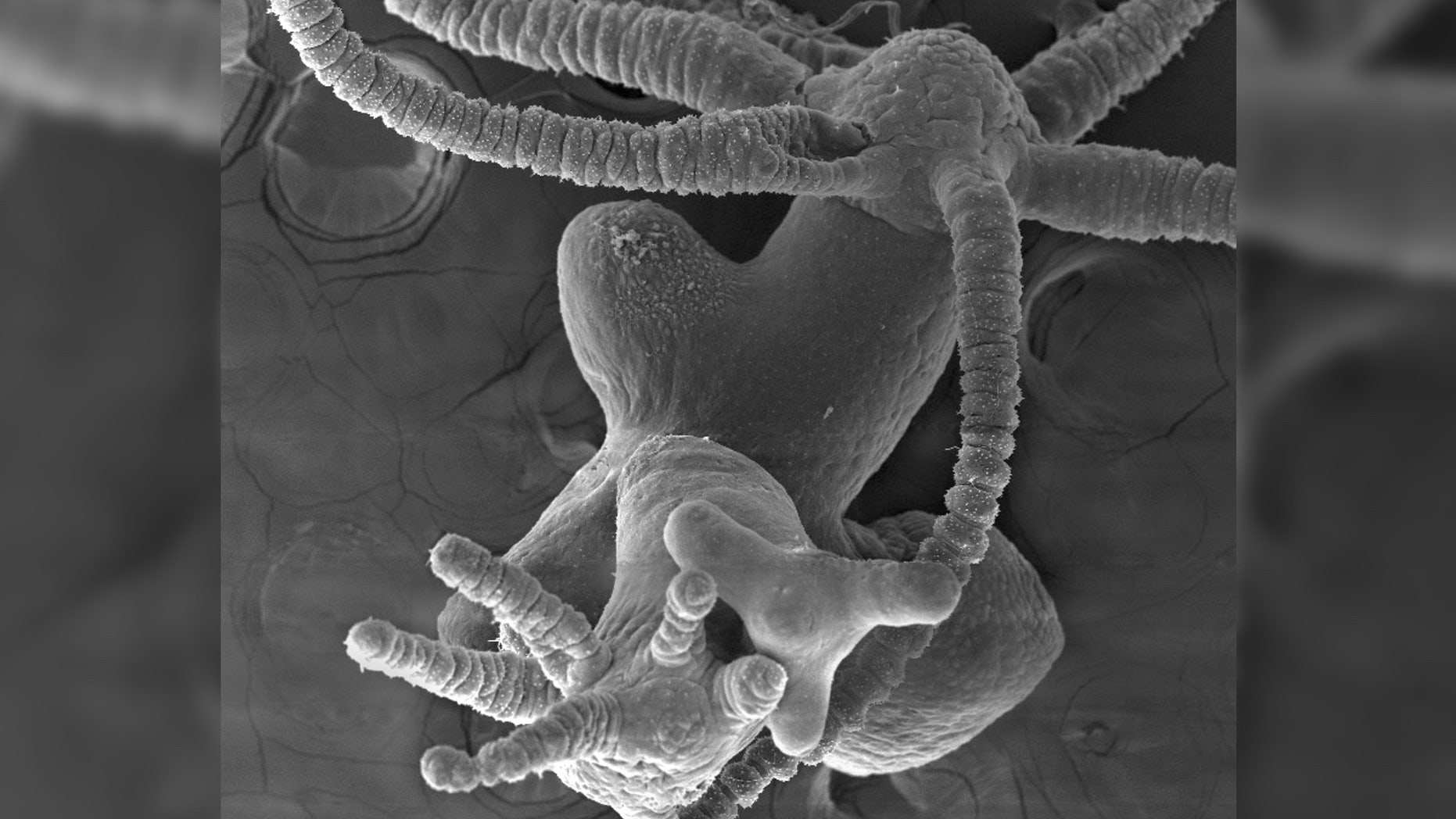 A hydra with too little of a protein called Sp5 develops multiple heads.