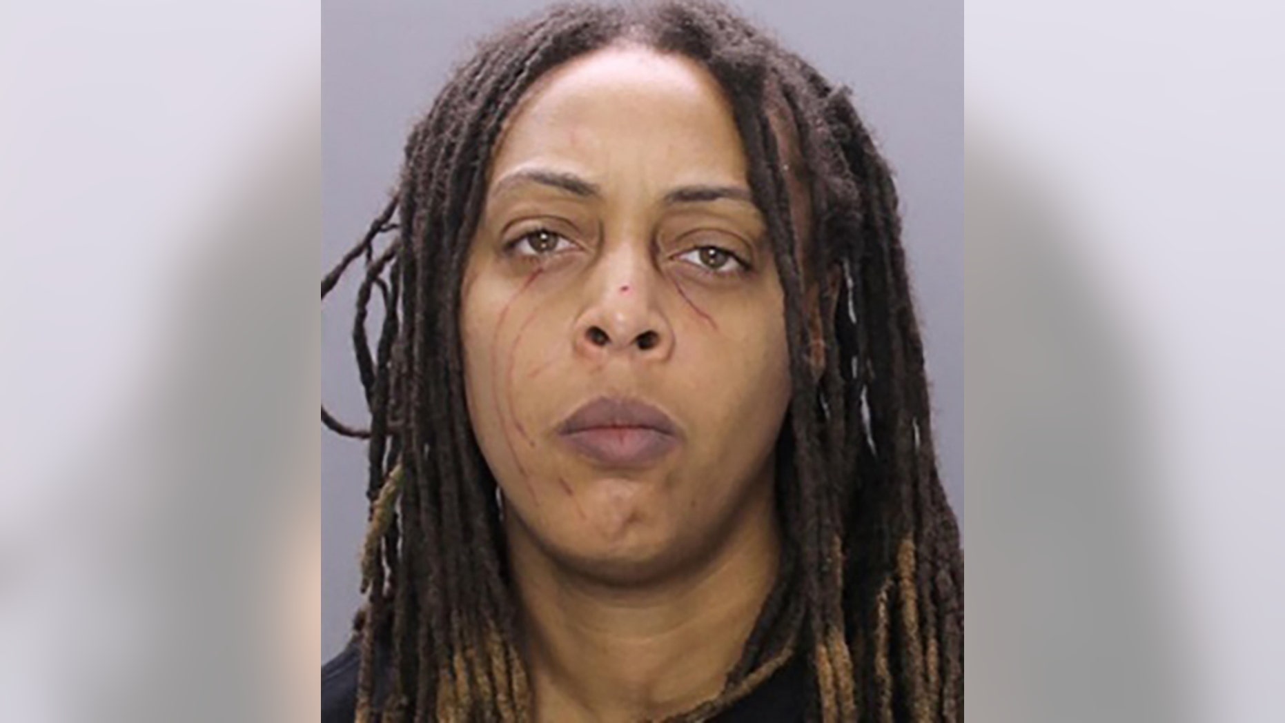 Kirsten Gaskins, 31, with scratch wounds visible on her face, allegedly attacked her girlfriend and stuck the girlfriend's dog inside a microwave after the Philadelphia Eagles lost to the New Orleans Saints in the NFL playoffs on Sunday, reports say.