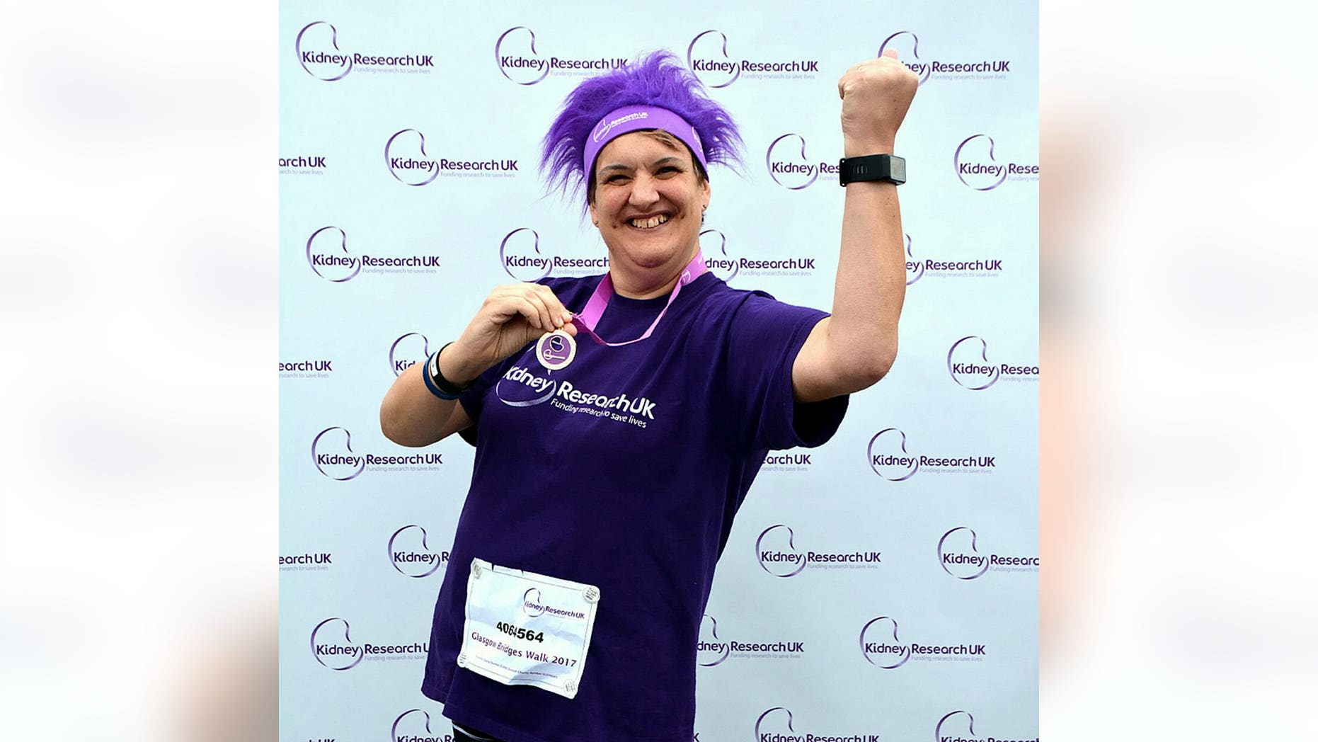 Dialysis nurse Rachel Cox is training for the London Marathon after donating a kindey to a stranger.