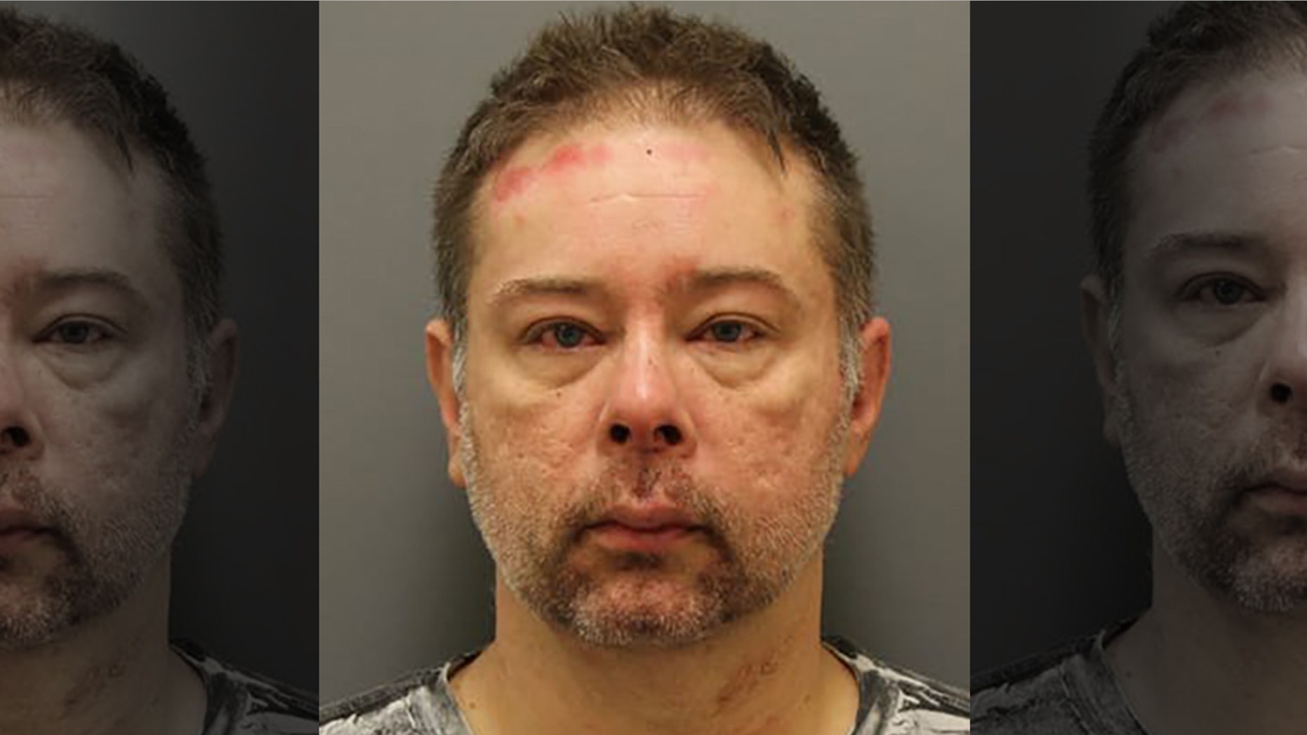 Christopher Rogers has been charged with DWI, resisting arrest, assault on a public servant, and aggravated assault after police said he bit off part of the ear of his arresting officer in Texas. (Denton Police Department)