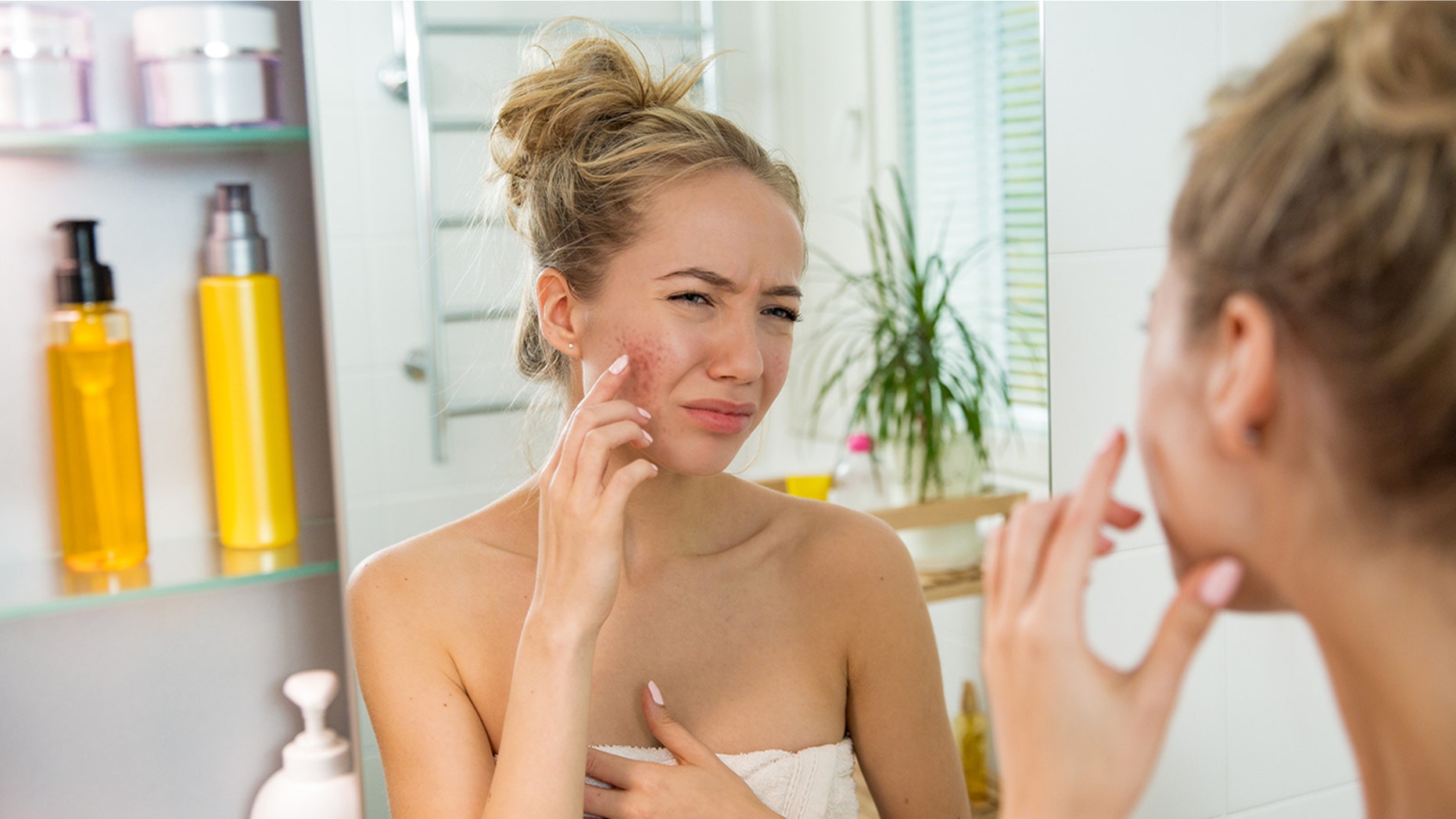 Try these tricks to combat red skin.