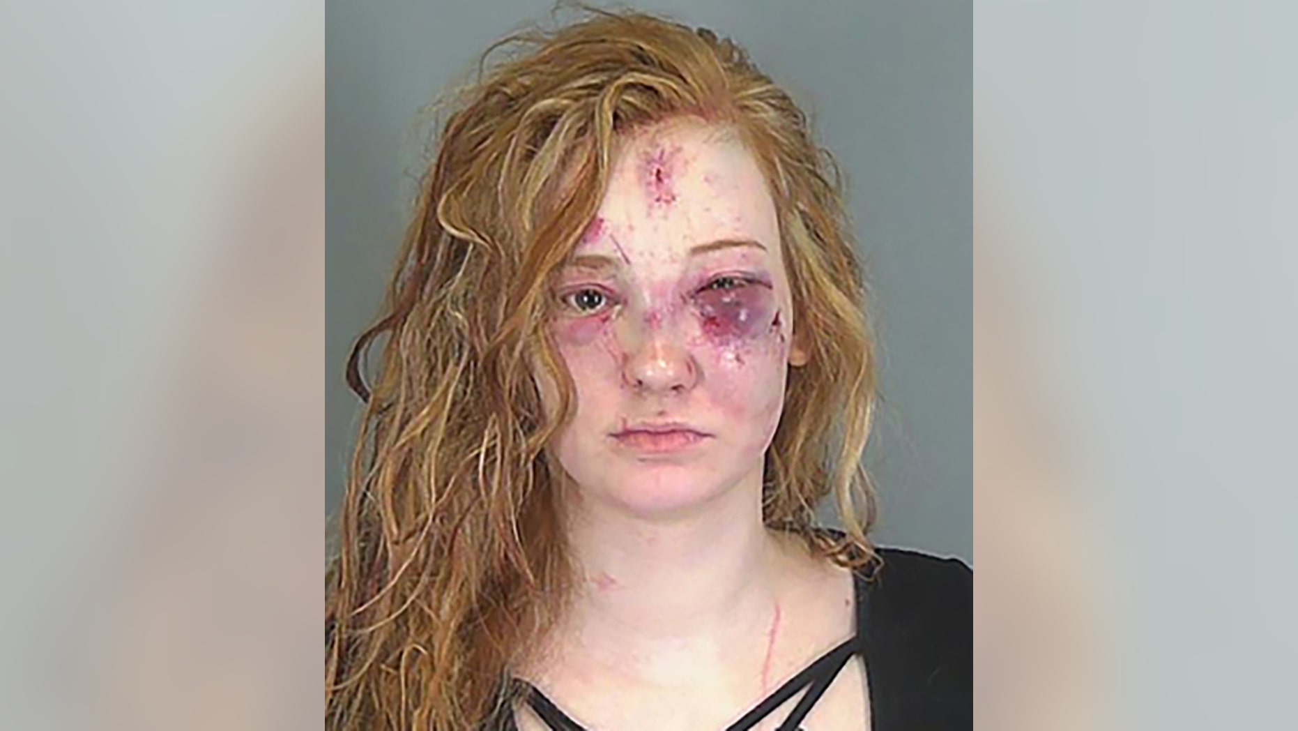 Savanna Grace White, 22, was arrested in an alleged stun-gun attack, police said.