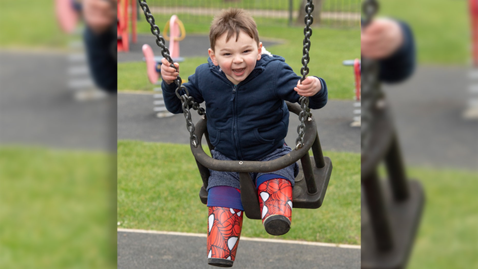 Tony was initial brought to a sanatorium with mixed fractures, organ disaster and sepsis during 41 days old.