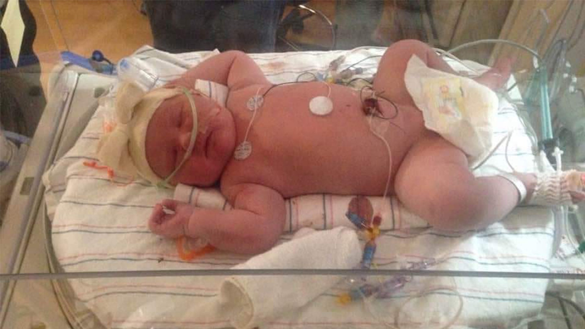Joy Buckley gave birth to a 15-ounce 15-ounce baby in a hospital in upstate New York on Tuesday.