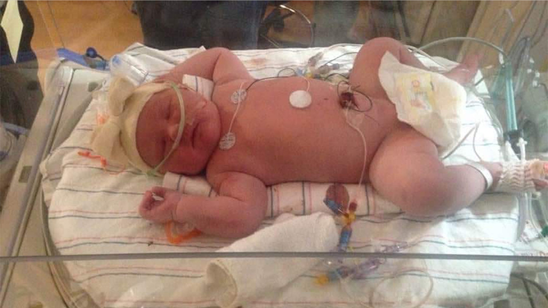 Joy Buckley gave birth to a 15-ounce 15-ounce baby in a hospital in upstate New York on Tuesday.