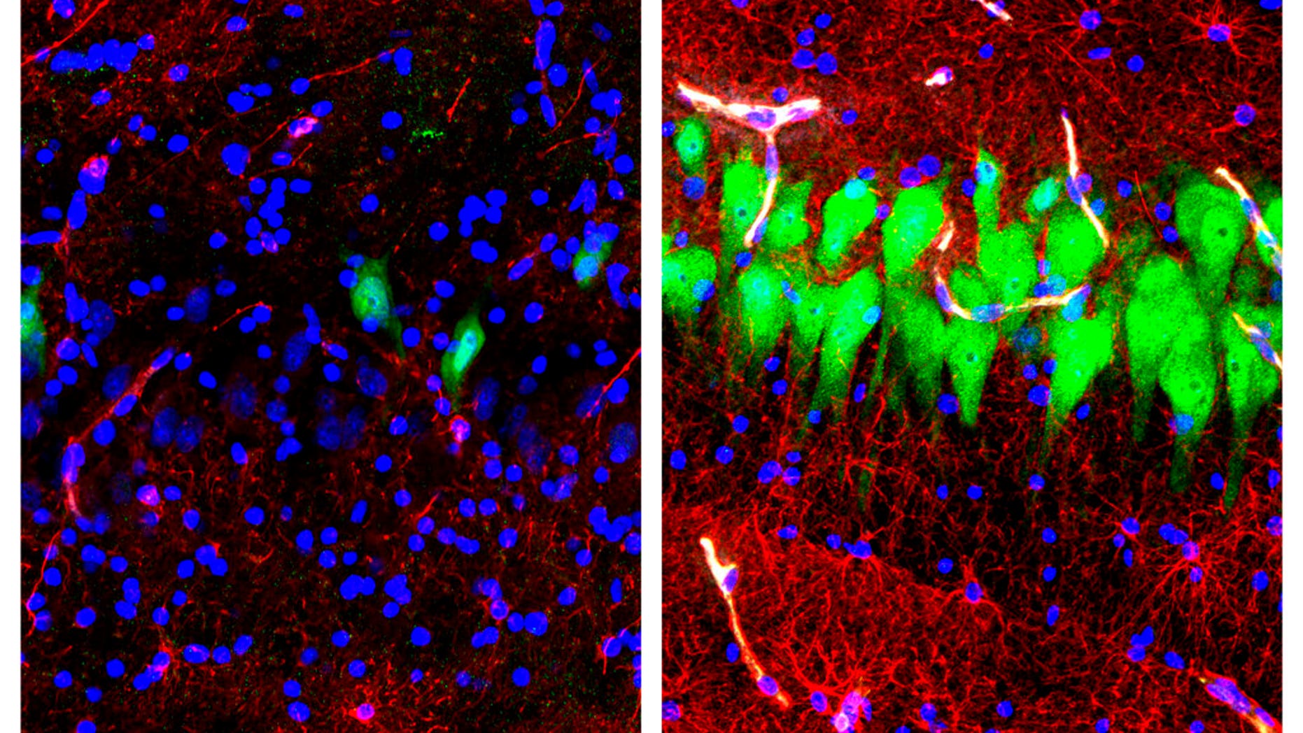 This combination of images provided by the Yale School of Medicine in April 2019 shows stained microscope photos of neurons, green; astrocytes, red, and cell nuclei, blue, from a pig brain left untreated for 10 hours after death, left, and another with a specially designed blood substitute pumped through it.