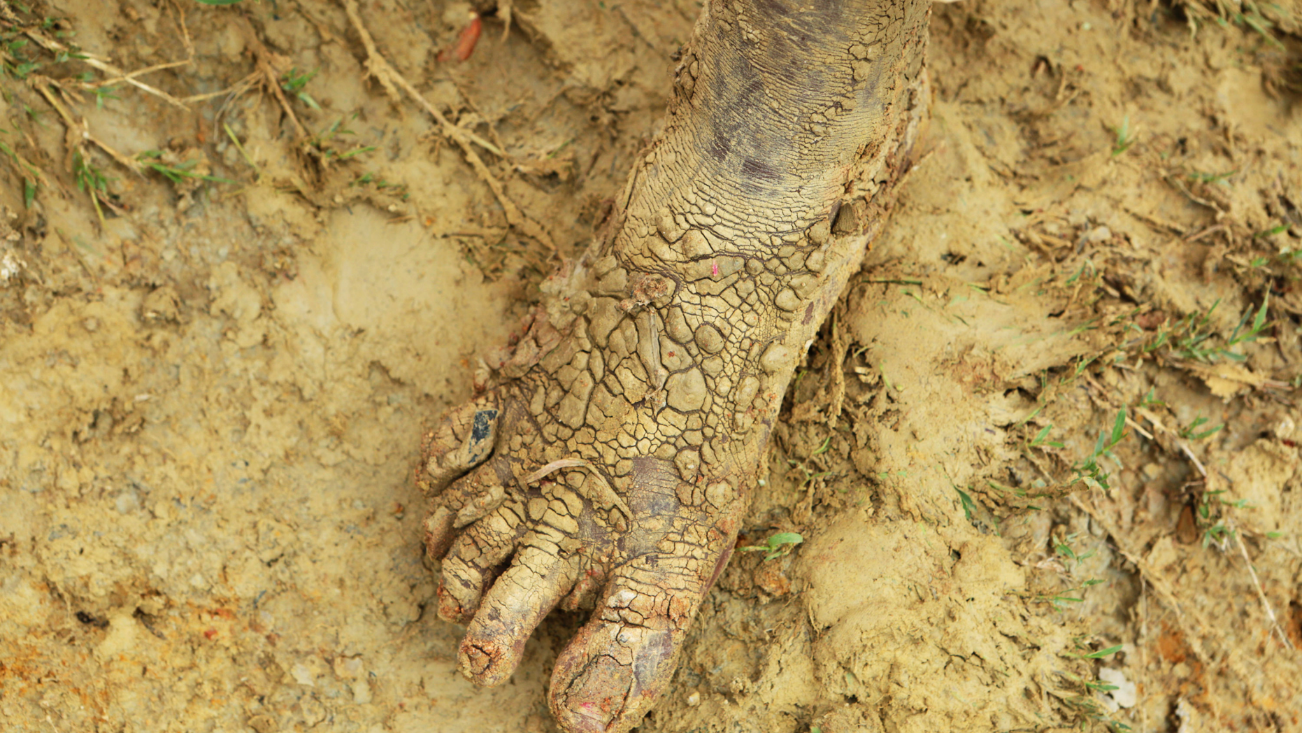 A woman shows one of her feet after walking in the mud near a site where two houses were crushed by the collapse of a massive, sprawling dumpsite that hit just after midnight when rains poured in Pemba city on the northeastern coast of Mozambique, Monday, April, 29, 2019. Mozambique's government says the death toll from last week's Cyclone Kenneth has jumped to 38 as flooding continues. (AP Photo/Tsvangirayi Mukwazhi)