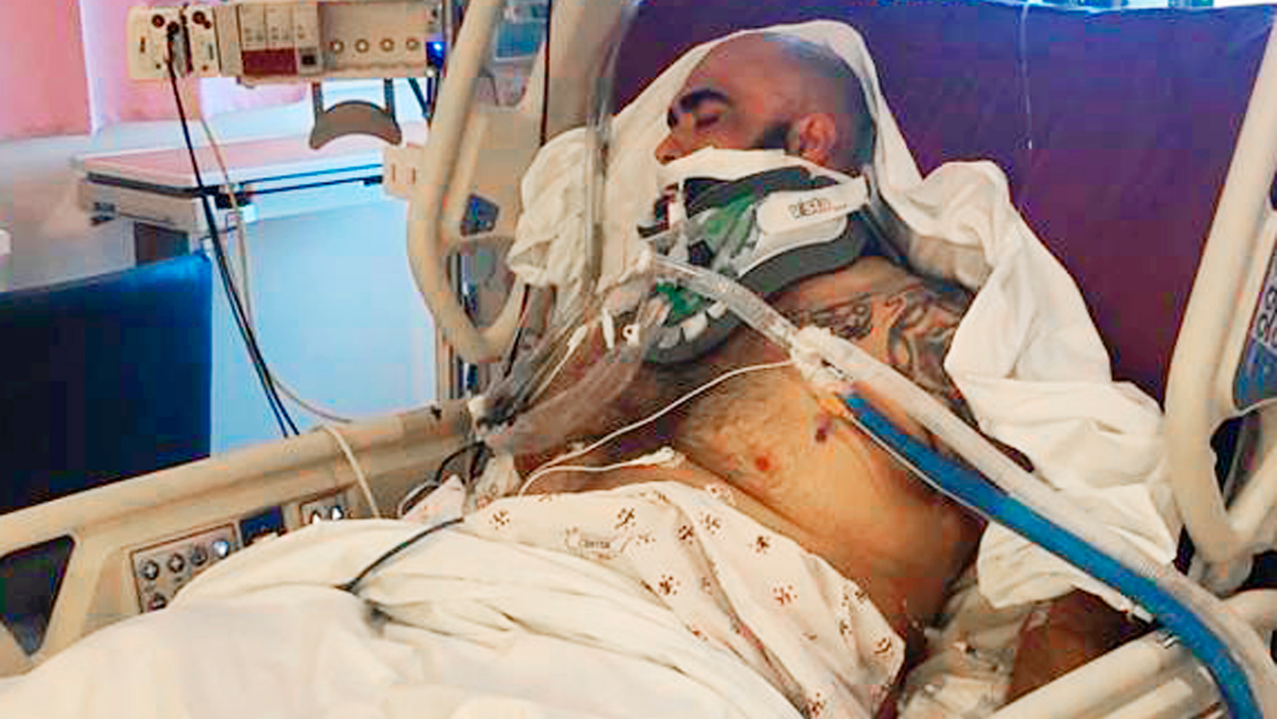 This undated photo provided by the Reyna family shows Rafael Reyna in his hospital bed at Los Angeles County-USC Medical Center in Los Angeles, after his beating outside Dodger Stadium. Bryan Stow, a San Francisco Giants fan who was left disabled in an attack outside Dodger Stadium that drew national attention eight years ago, said he's dismayed that Los Angeles police are again investigating an assault at the baseball stadium that left a man seriously injured. Authorities searched Monday, April 1, 2019, for a man who punched Rafael Reyna during an argument following Friday night's game. Christel Reyna says her husband Rafael sustained a skull fracture and is on life support.(Courtesy Reyna Family via AP)
