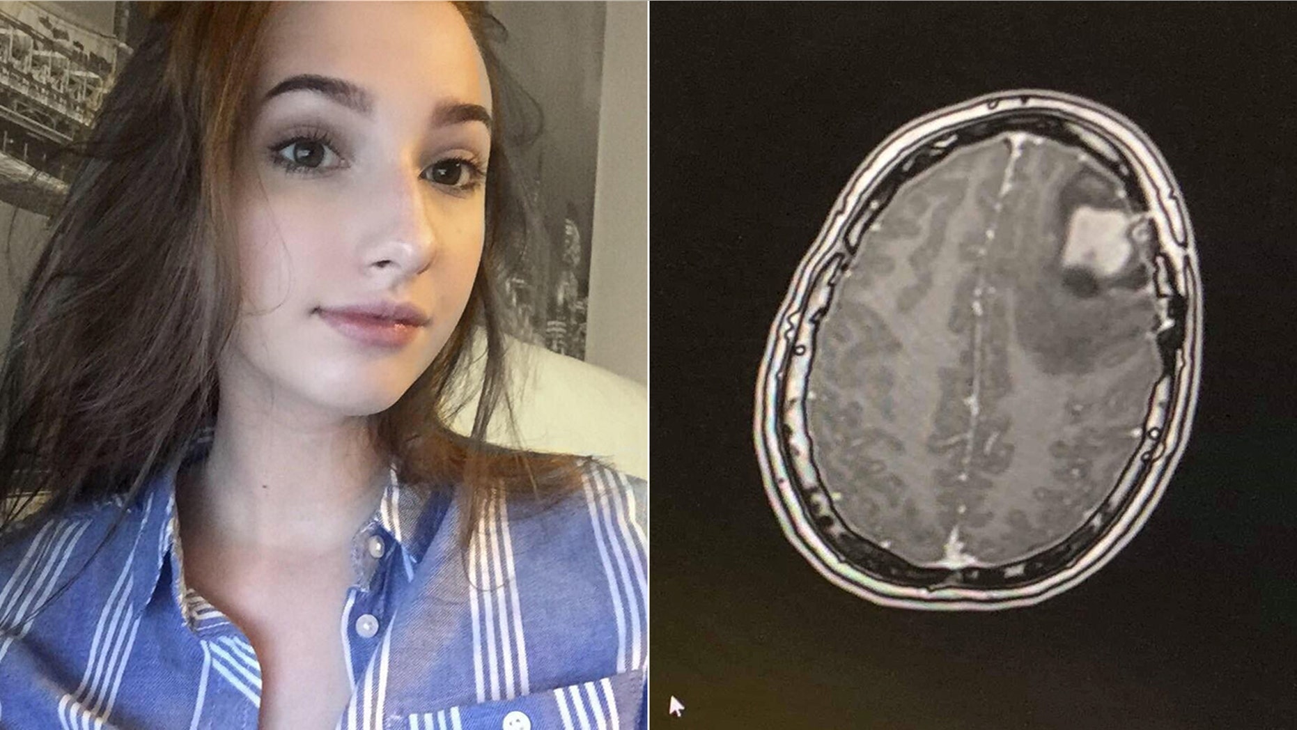 Hiley said she was forced to postpone her studies when the pain was causing her to vomit.