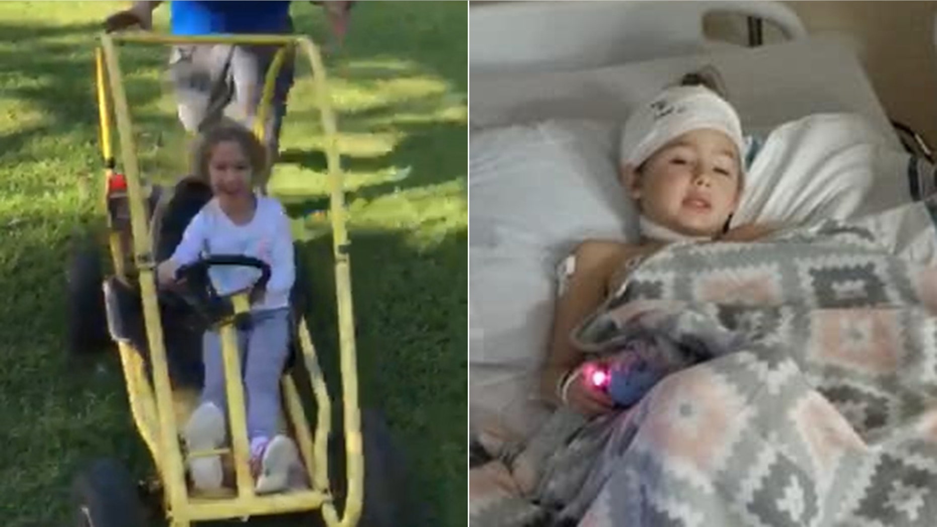 Lani Use, pictured left moments before her horrific accident, and right after her emergency surgery, had been riding in the go-kart at a family party when her hair got stuck in the vehicle's motor.