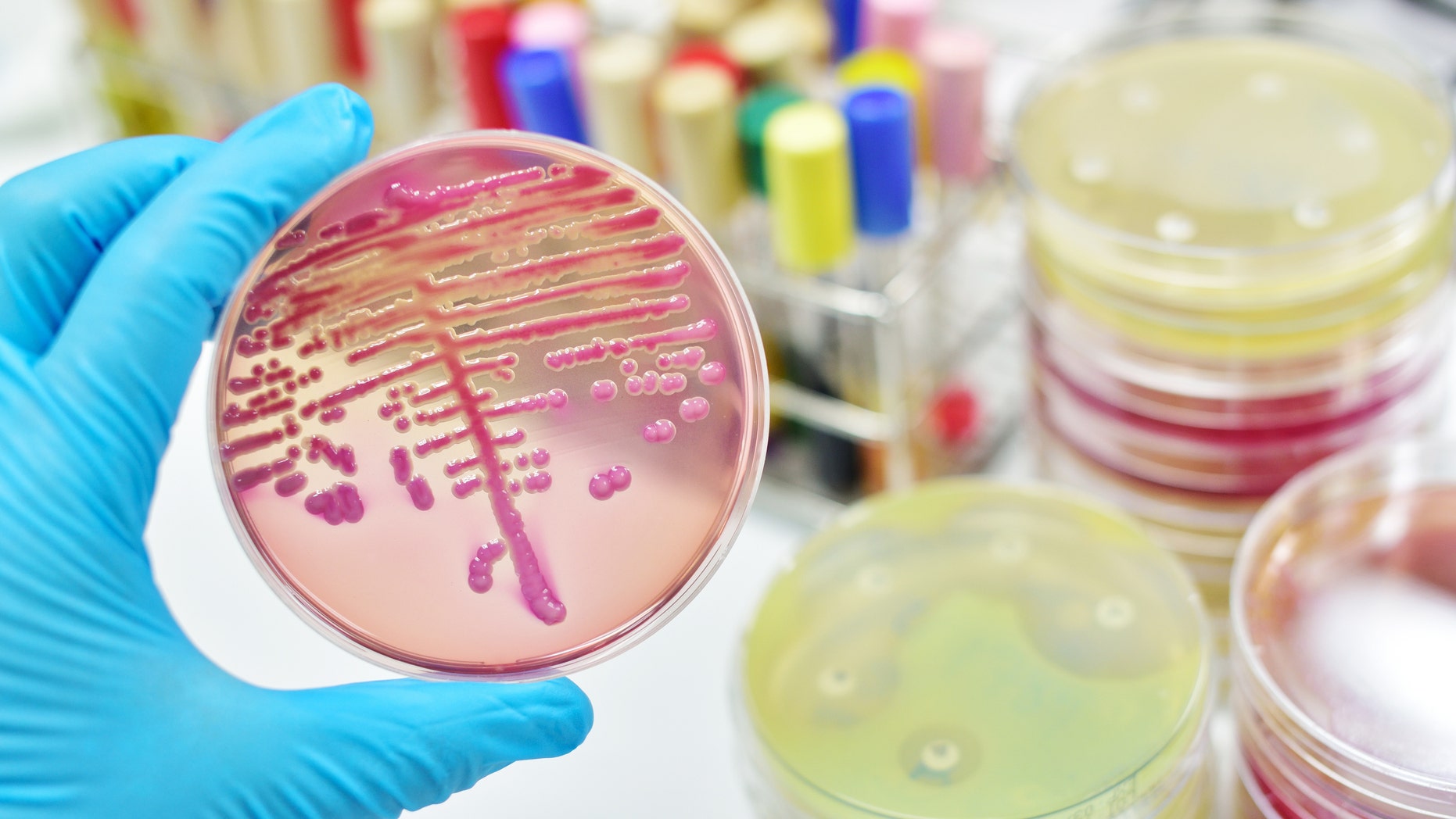 Deadly Fungal Superbug Spreads Worldwide Alarming Scientists Fox News