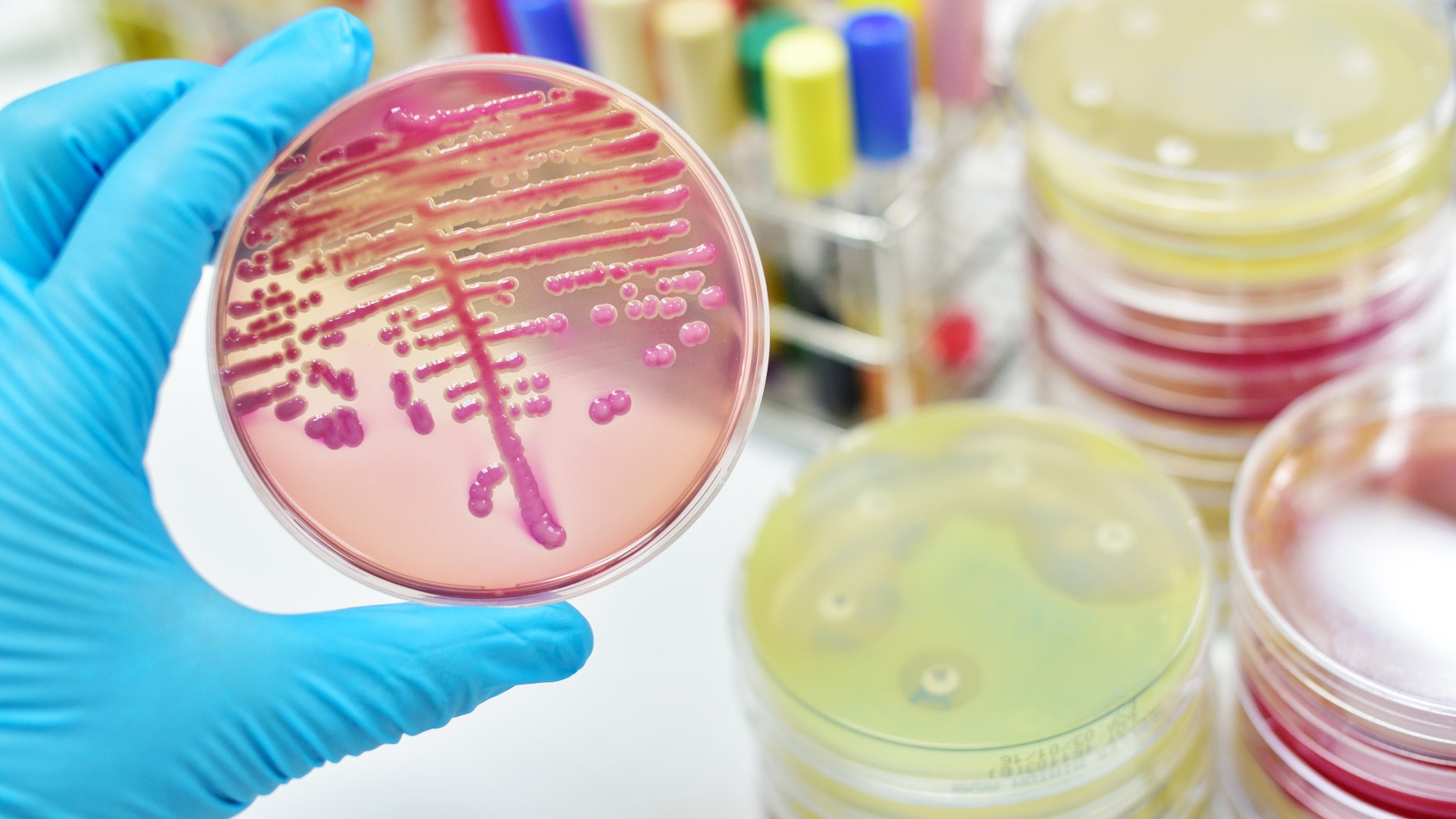 The fungus, called Candida auris, is a yeast that normally lives harmlessly on the skin and mucous membranes.