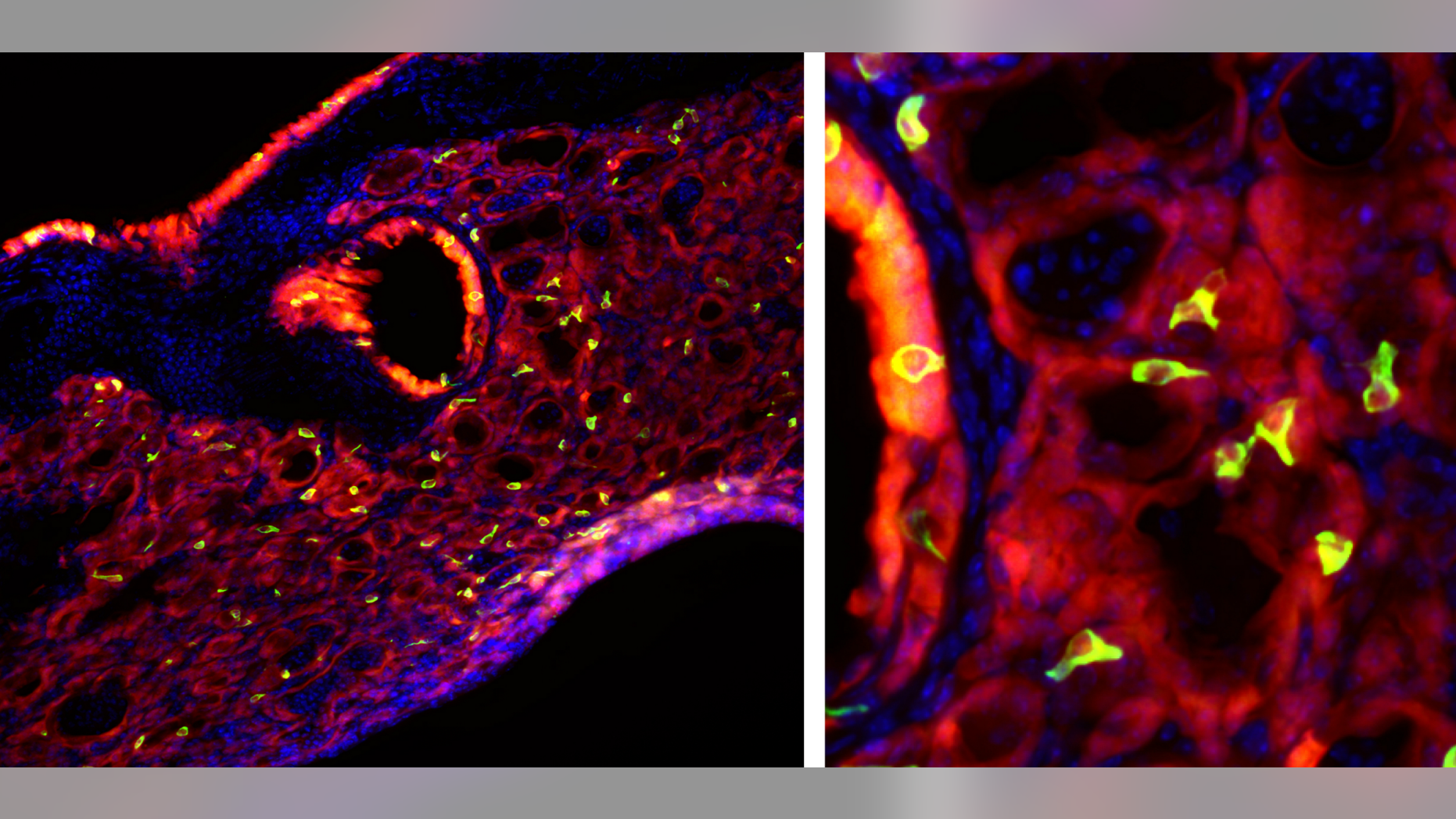 Bright green tuft cells, which are found in taste buds, are seen throughout mouse lung tissue after an infection with the flu.