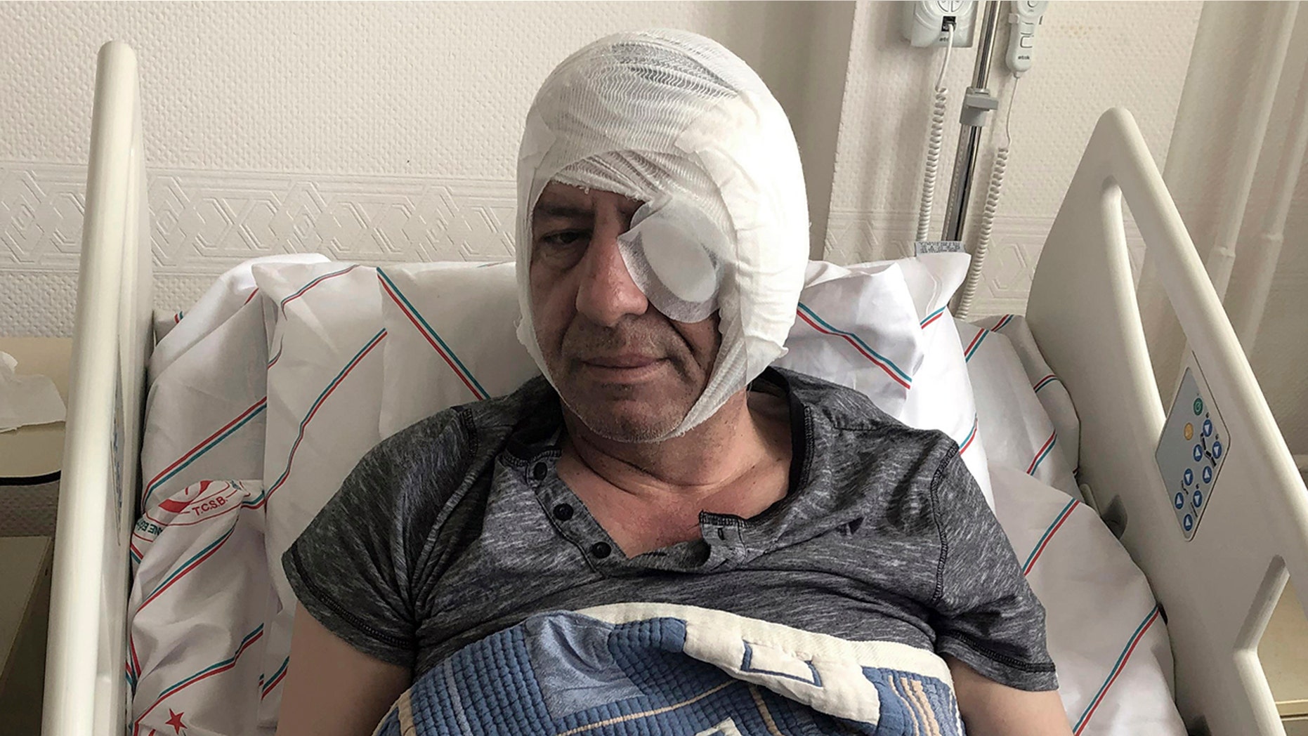 Yavuz Selim Demirag, a Turkish journalist critical of President Recep Tayyip Erdogan's government and its nationalist allies, rests in a hospital bed in Ankara, Turkey, Saturday, May 11, 2019. Yenicag newspaper says Saturday columnist Demirag was beaten by a group of about five or six people with baseball bats outside his home after appearing on a TV show late Friday.(AP Photo/Burhan Ozbilici)