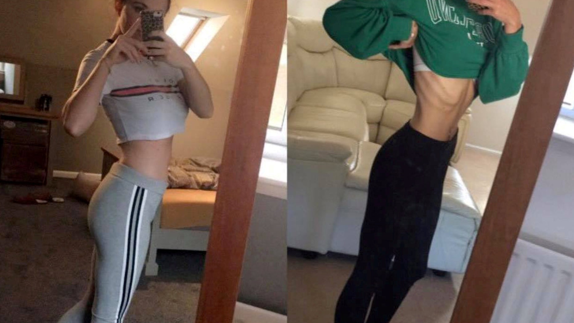 (L-R) Chloe Frome's recovery at 4 weeks, and how she looked before.