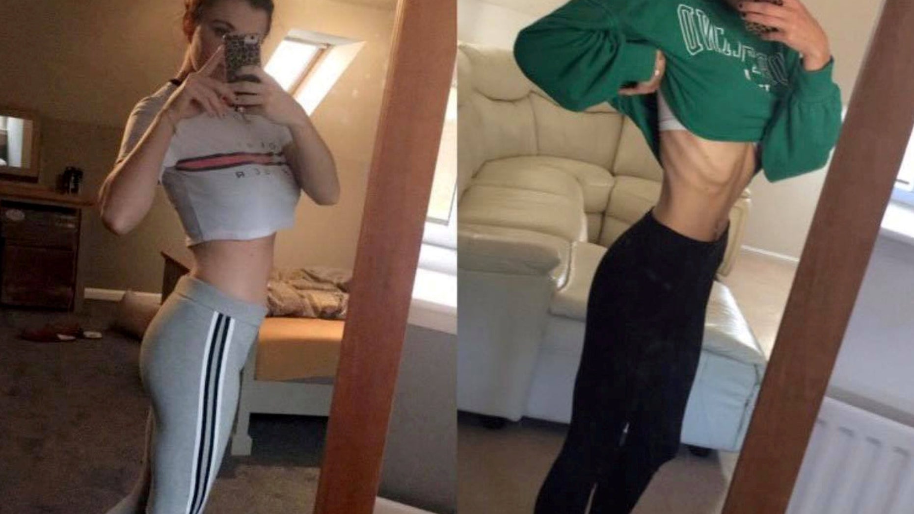 (L-R) Chloe Frome's recovery at 4 weeks, and how she looked before.