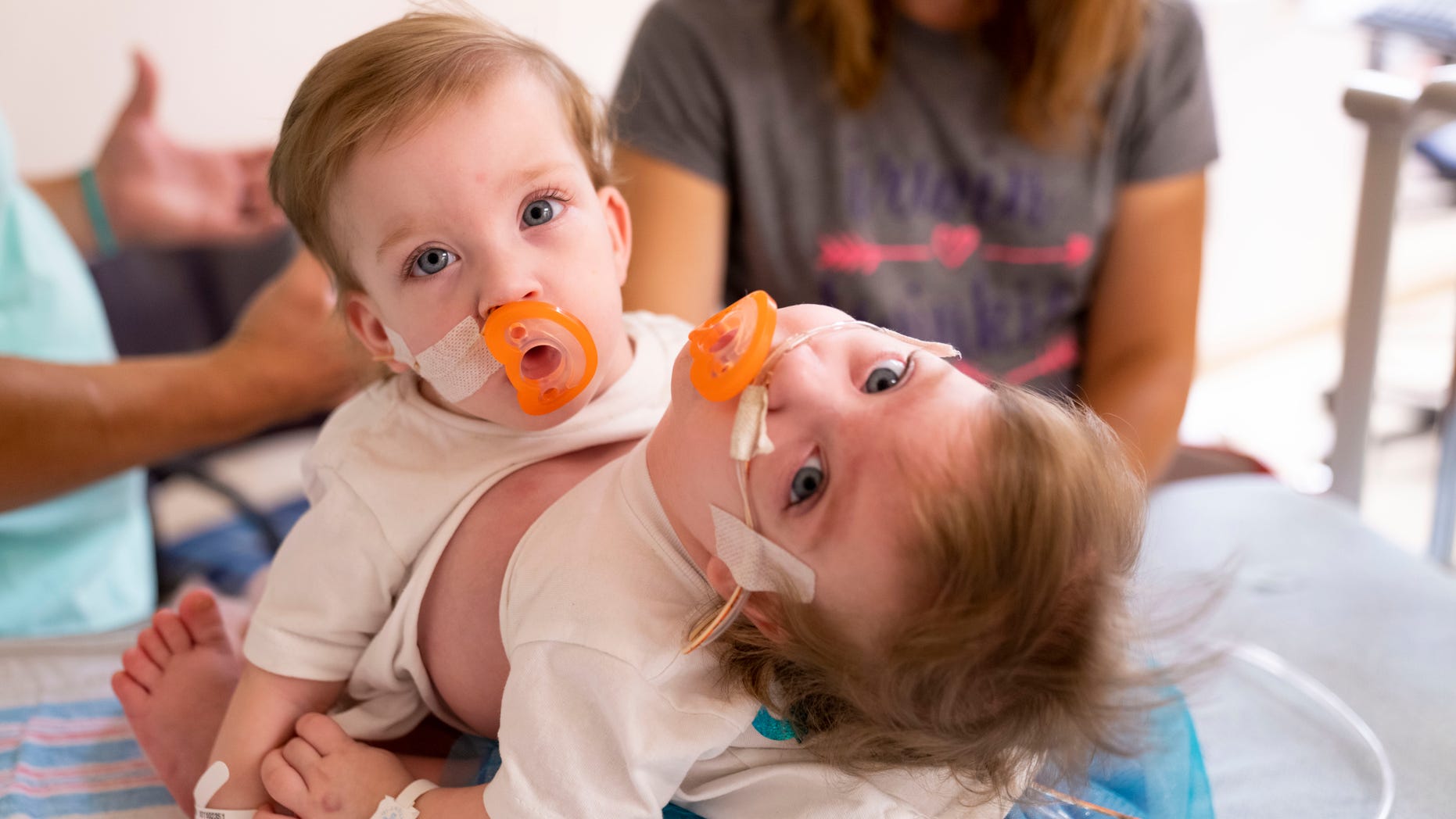 Sarabeth and Amelia were born connected from the chest down to the belly button.