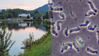 North Carolina teen critically ill after contracting rare brain-eating amoeba - Fox News