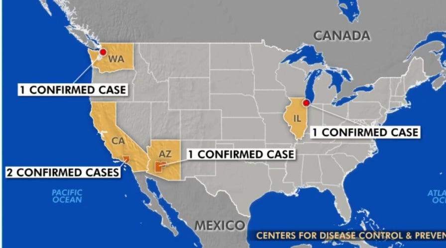 5 confirmed cases of coronavirus in the US