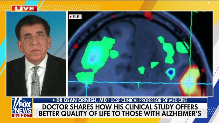 Clinical study improved Alzheimer's symptoms without drugs