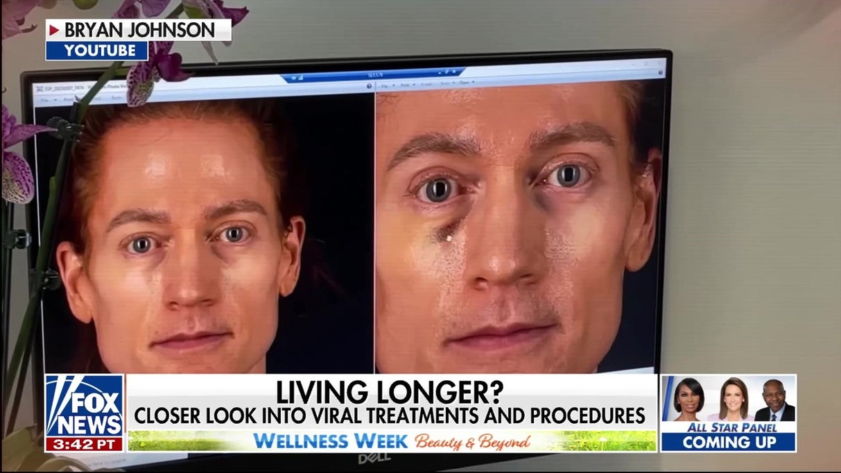 Red light therapy, cold plunges among viral beauty longevity trends