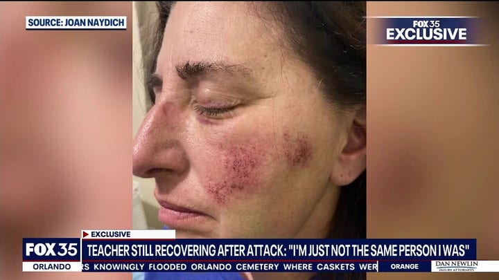 Florida teacher's aide beaten by student in viral video attack speaks out