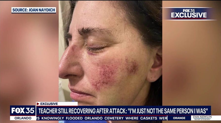 Florida teacher's aide beaten by student in viral video attack speaks out