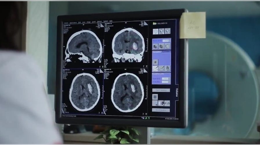 Dr. Eben Alexander describes his near-death experience  -  and the miracle that saved his life